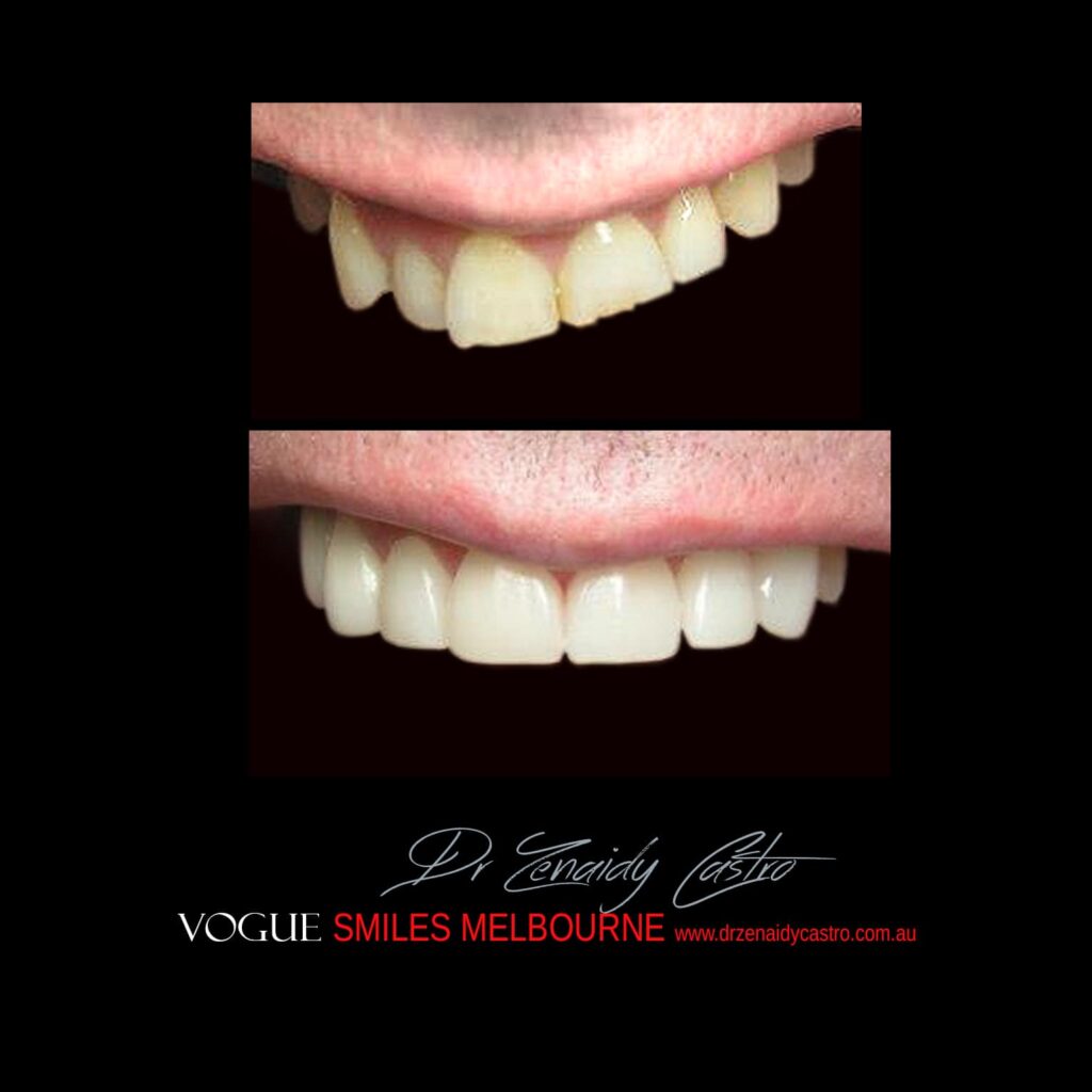 VOGUE-SMILES-COSMETIC-DENTISTRY-TREATMENT