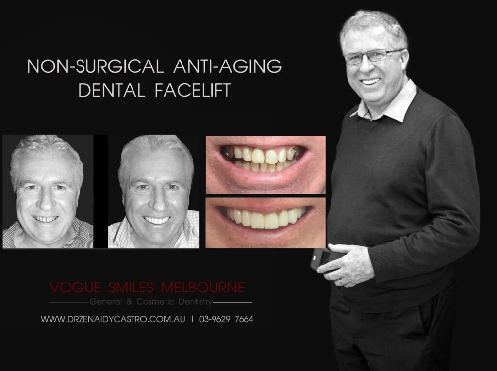 VOGUE-SMILES-COSMETIC-DENTISTRY