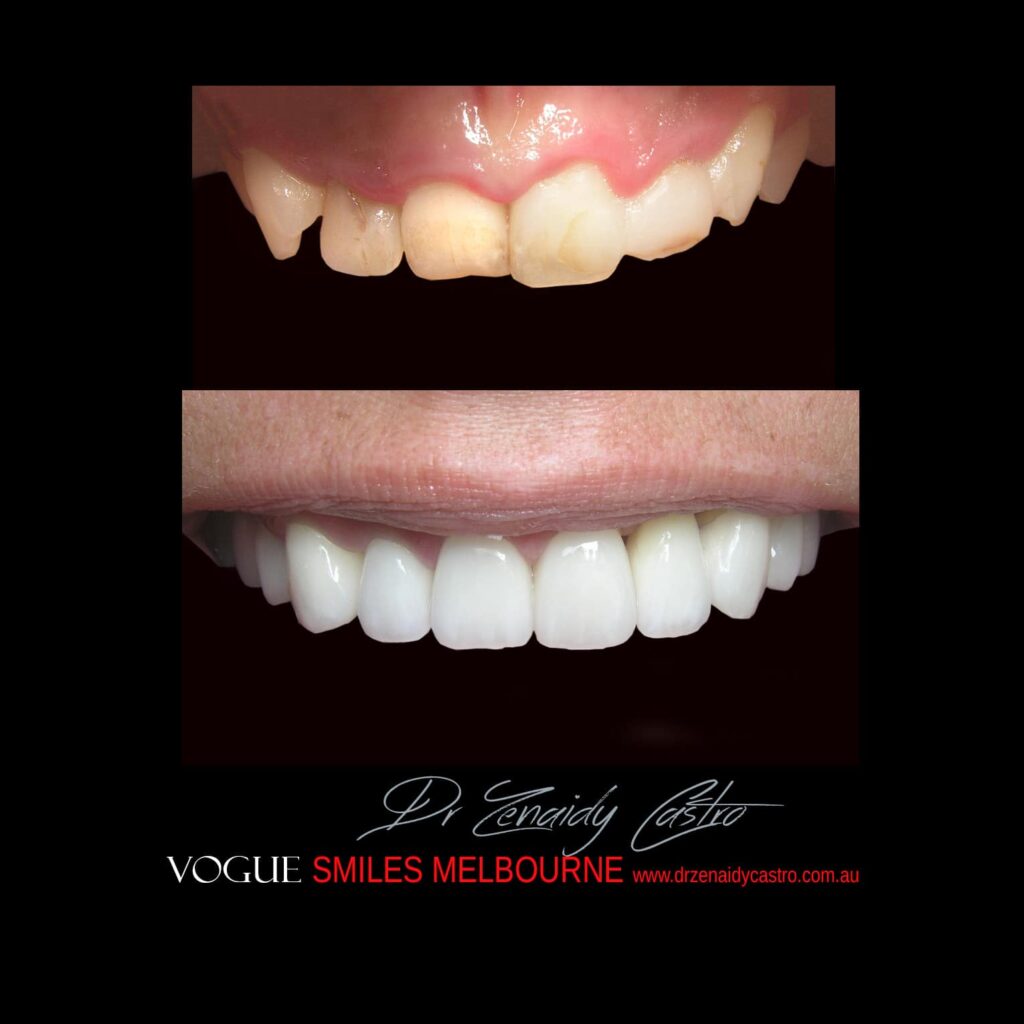 VOGUE-SMILES-COSMETIC-DENTISTRY-TREATMENT