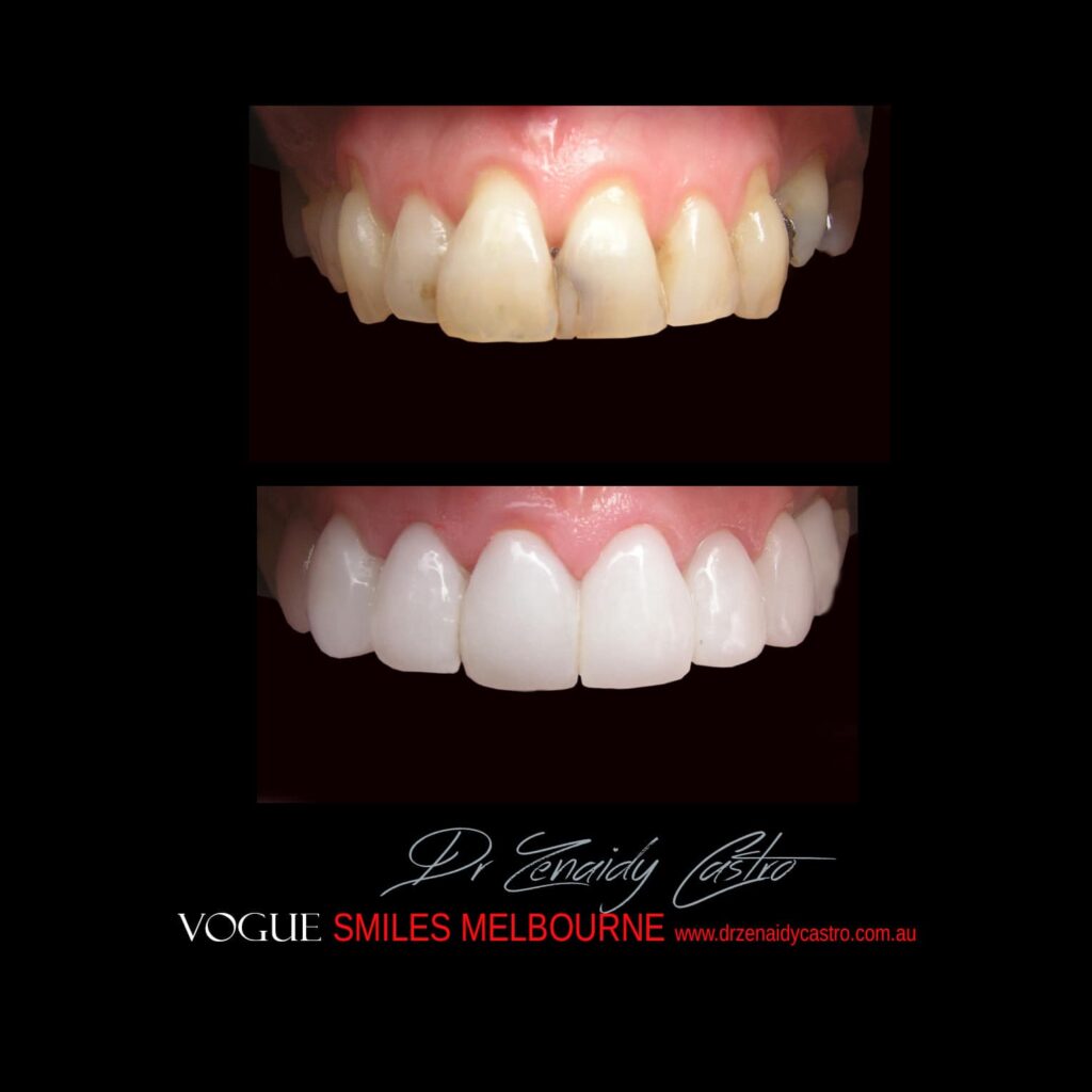 VOGUE-SMILES-COSMETIC-DENTISTRY-TREATMENT