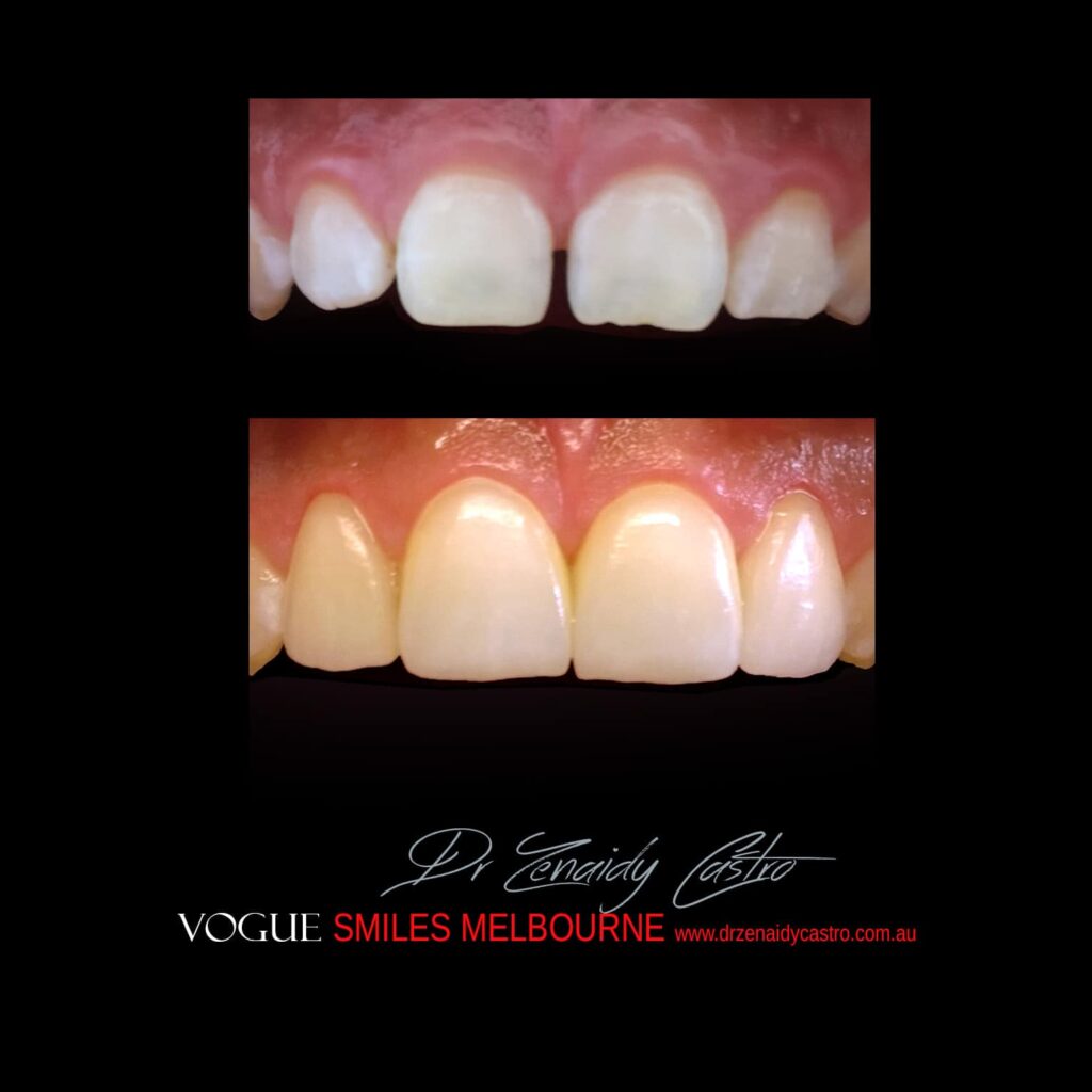 VOGUE-SMILES-COSMETIC-DENTISTRY-TREATMENT