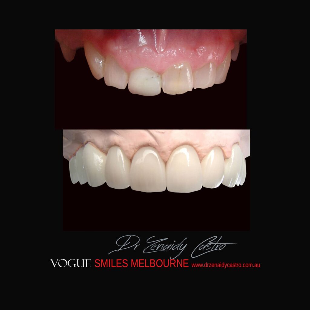 VOGUE-SMILES-COSMETIC-DENTISTRY-TREATMENT