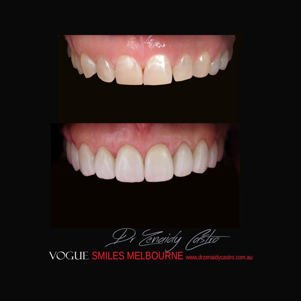 VOGUE-SMILES-COSMETIC-DENTISTRY-TREATMENT