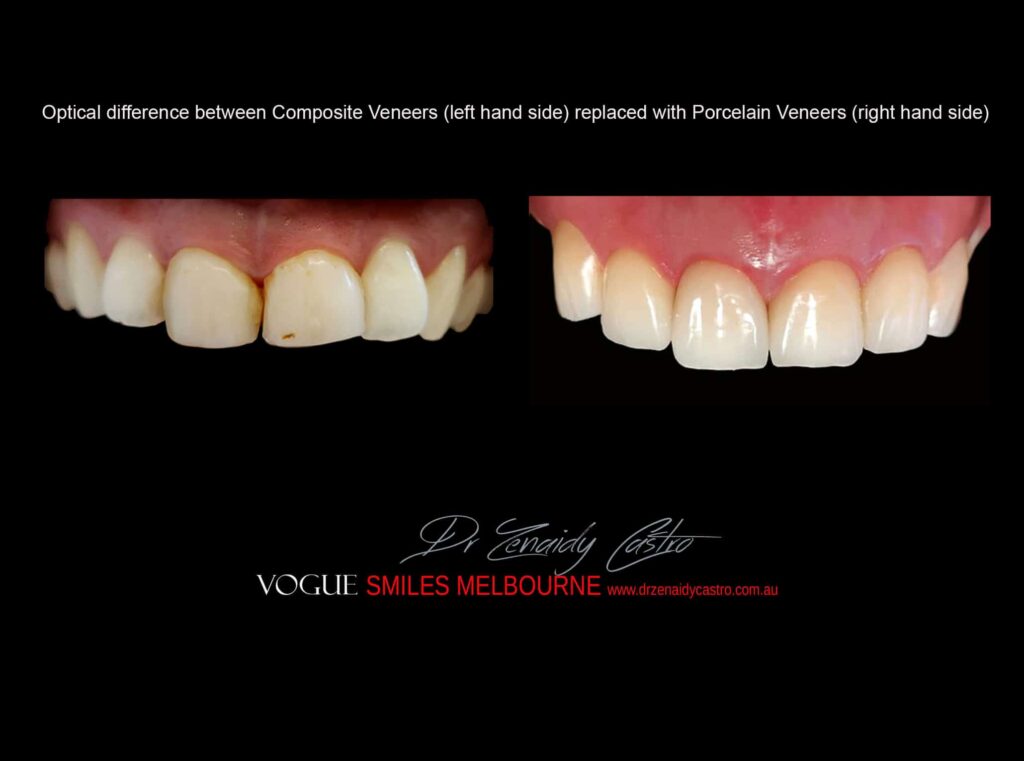 VOGUE-SMILES-COSMETIC-DENTISTRY-TREATMENT
