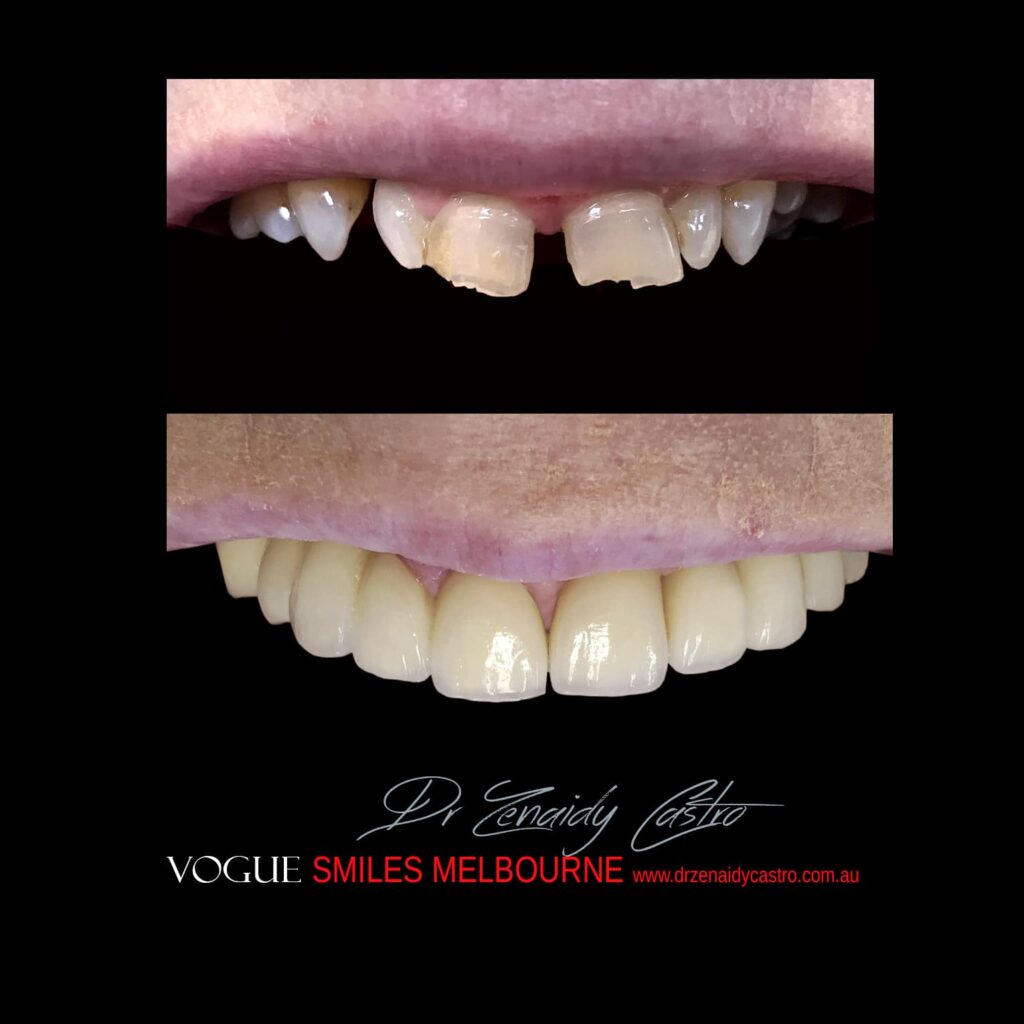 VOGUE-SMILES-COSMETIC-DENTISTRY-TREATMENT