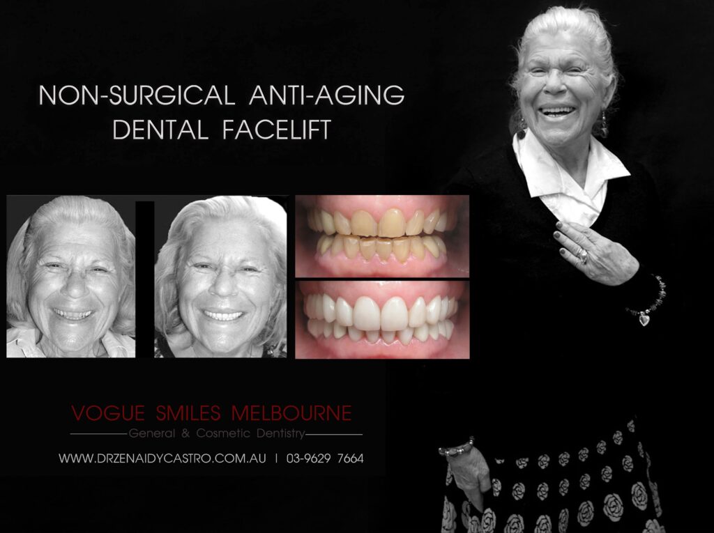 VOGUE-SMILES-COSMETIC-DENTISTRY