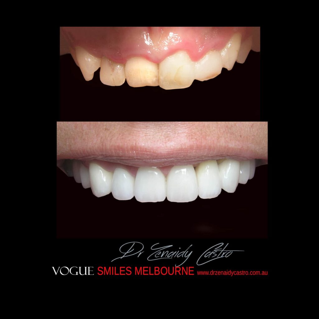 VOGUE-SMILES-COSMETIC-DENTISTRY-TREATMENT