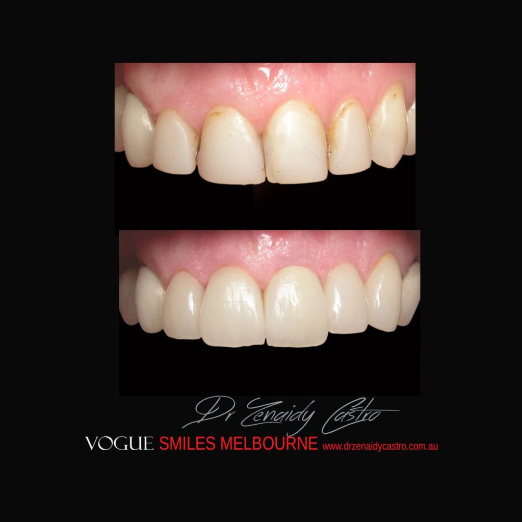 VOGUE-SMILES-COSMETIC-DENTISTRY-TREATMENT