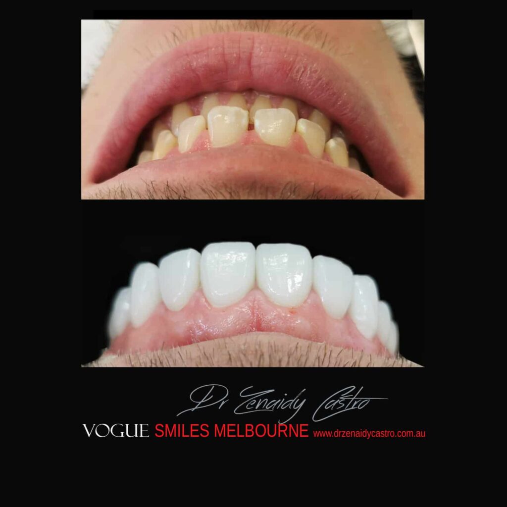 VOGUE-SMILES-COSMETIC-DENTISTRY-TREATMENT