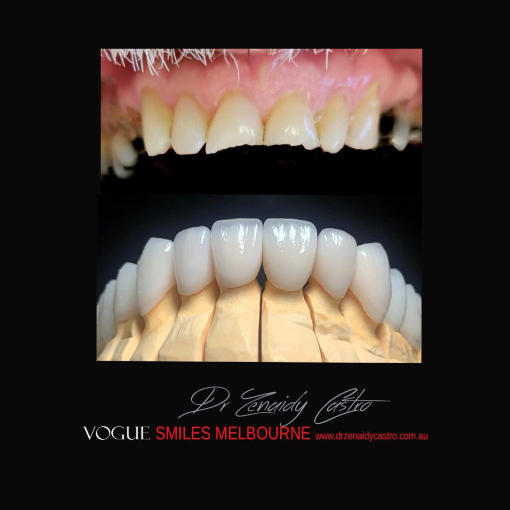 VOGUE-SMILES-COSMETIC-DENTISTRY-TREATMENT