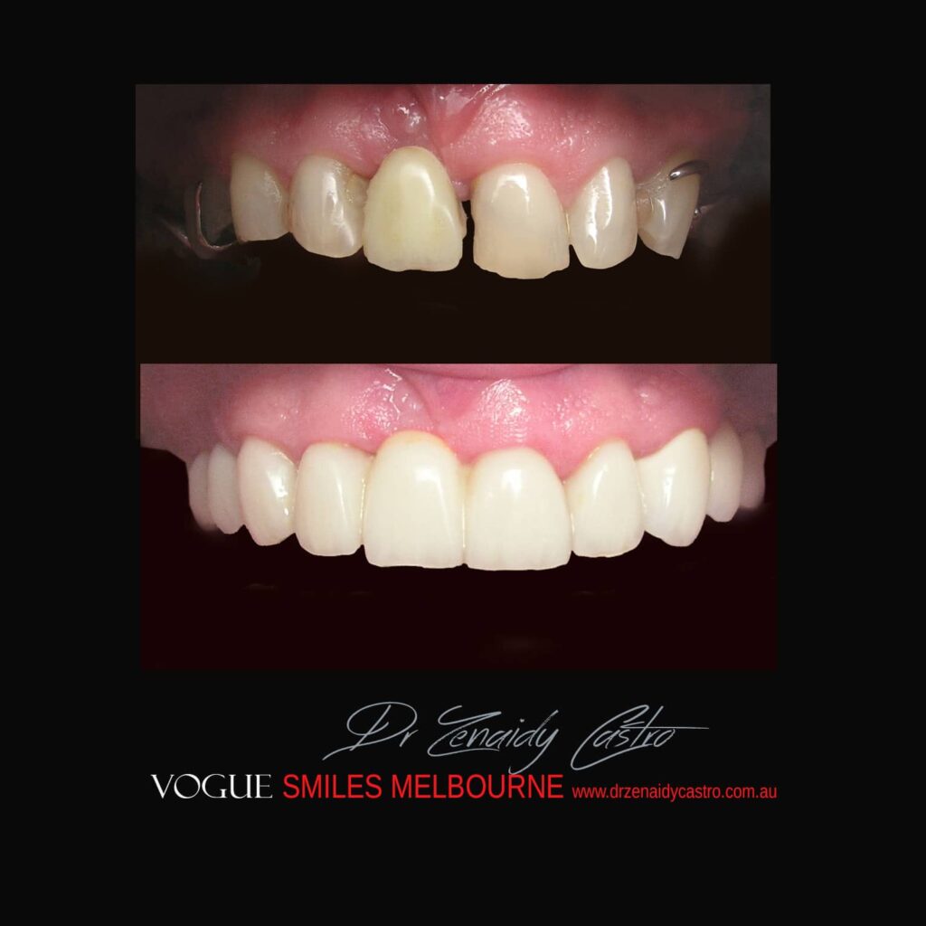VOGUE-SMILES-COSMETIC-DENTISTRY-TREATMENT