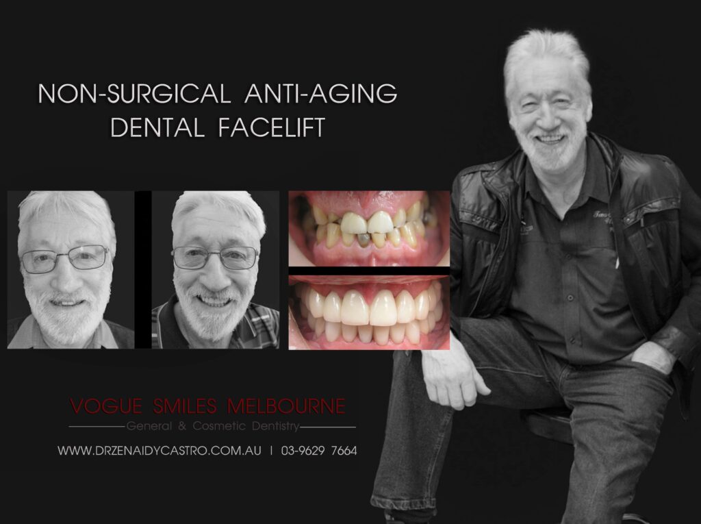 VOGUE-SMILES-COSMETIC-DENTISTRY