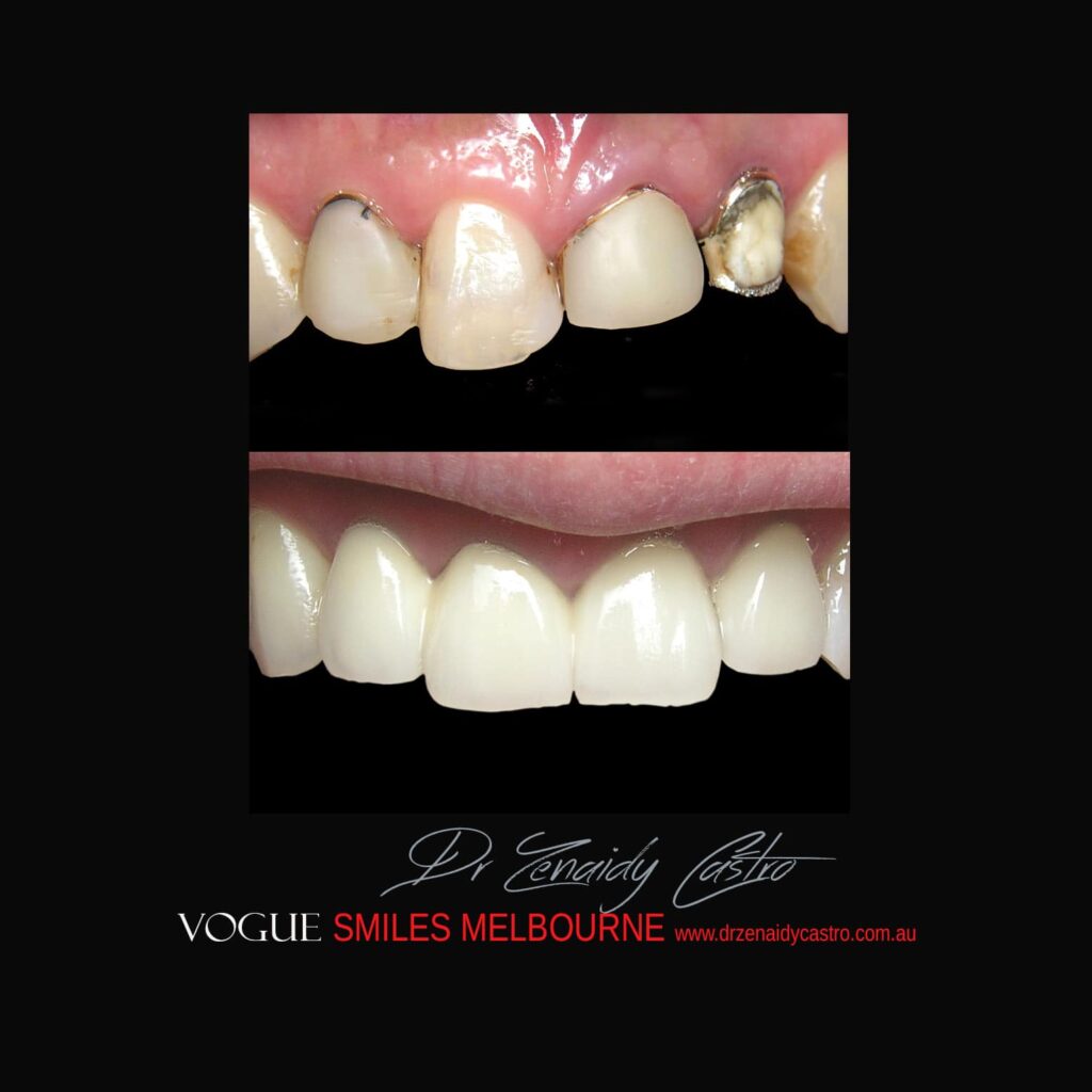VOGUE-SMILES-COSMETIC-DENTISTRY-TREATMENT