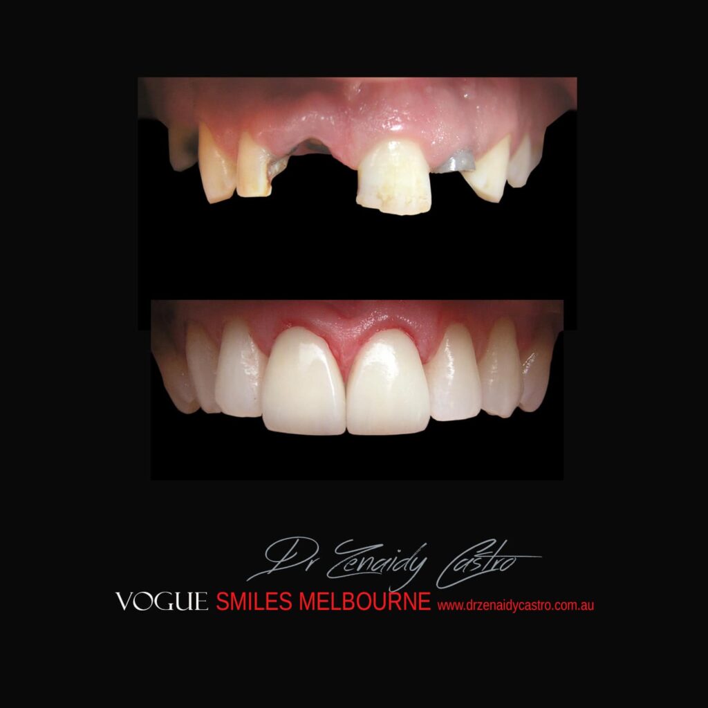 VOGUE-SMILES-COSMETIC-DENTISTRY-TREATMENT
