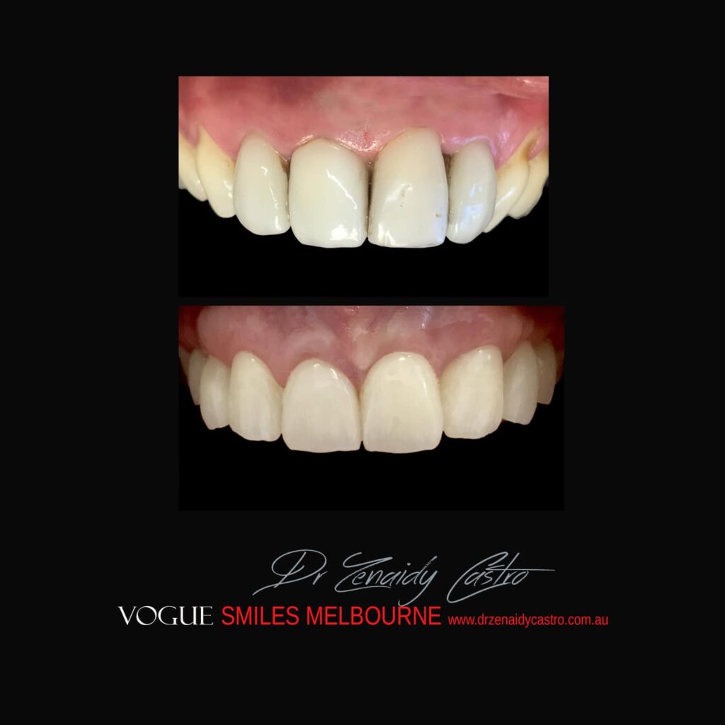 VOGUE-SMILES-COSMETIC-DENTISTRY-TREATMENT