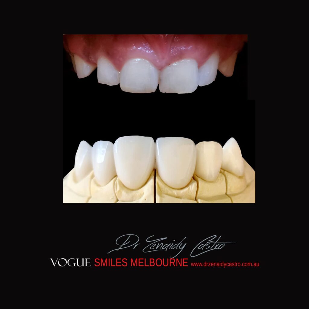 VOGUE-SMILES-COSMETIC-DENTISTRY-TREATMENT