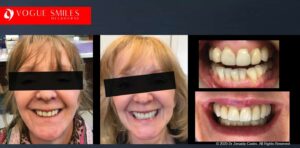 Non-Surgical Treatment for Premature Facial Aging Melbourne, Cheapest Cosmetic Dentist Near Me for Smile Makeovers, Cosmetic Dentistry in Noble Park North, Affordable Smile Makeover Dentistry in Noble Park North. General Dentist Noble Park North- Best Dentist in Noble Park North - Best Dental Clinic in Noble Park North, Best Cosmetic Dentist in Noble Park North. Serving surrounding suburbs Dandenong North, Mulgrave, Springvale, Springvale South, Noble Park, Rowville, Wheelers Hill, Keysborough, and Endeavour Hills, Mulgrave, Glen Waverly