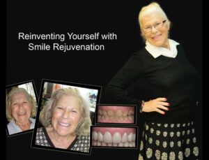 Stop Looking Older Than Your Age - Smile Rejuvenation, Cheapest Cosmetic Dentist Near Me for Smile Makeovers, Cosmetic Dentistry in Noble Park North, Affordable Smile Makeover Dentistry in Noble Park North. General Dentist Noble Park North- Best Dentist in Noble Park North - Best Dental Clinic in Noble Park North, Best Cosmetic Dentist in Noble Park North. Serving surrounding suburbs Dandenong North, Mulgrave, Springvale, Springvale South, Noble Park, Rowville, Wheelers Hill, Keysborough, and Endeavour Hills, Mulgrave, Glen Waverly