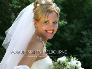 Wedding Day Smile Makeover : Your Cosmetic Dentistry Guide