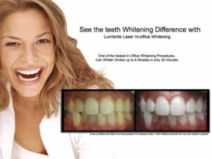 Affordable Laser Whitening in Melbourne & Noble Park, Cheapest Cosmetic Dentist Near Me for Smile Makeovers, Cosmetic Dentistry in Noble Park North, Affordable Smile Makeover Dentistry in Noble Park North. General Dentist Noble Park North- Best Dentist in Noble Park North - Best Dental Clinic in Noble Park North, Best Cosmetic Dentist in Noble Park North. Serving surrounding suburbs Dandenong North, Mulgrave, Springvale, Springvale South, Noble Park, Rowville, Wheelers Hill, Keysborough, and Endeavour Hills, Mulgrave, Glen Waverly