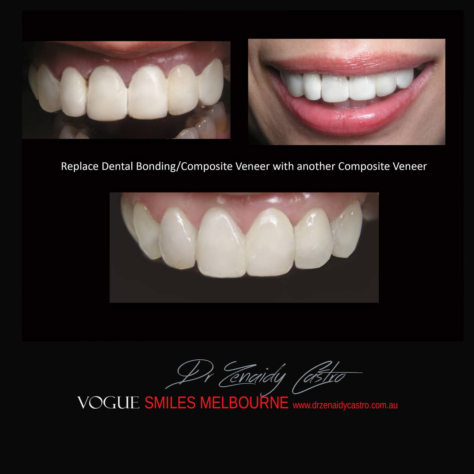 Affordable-Cheap-Cosmetic-Smile-Makeover