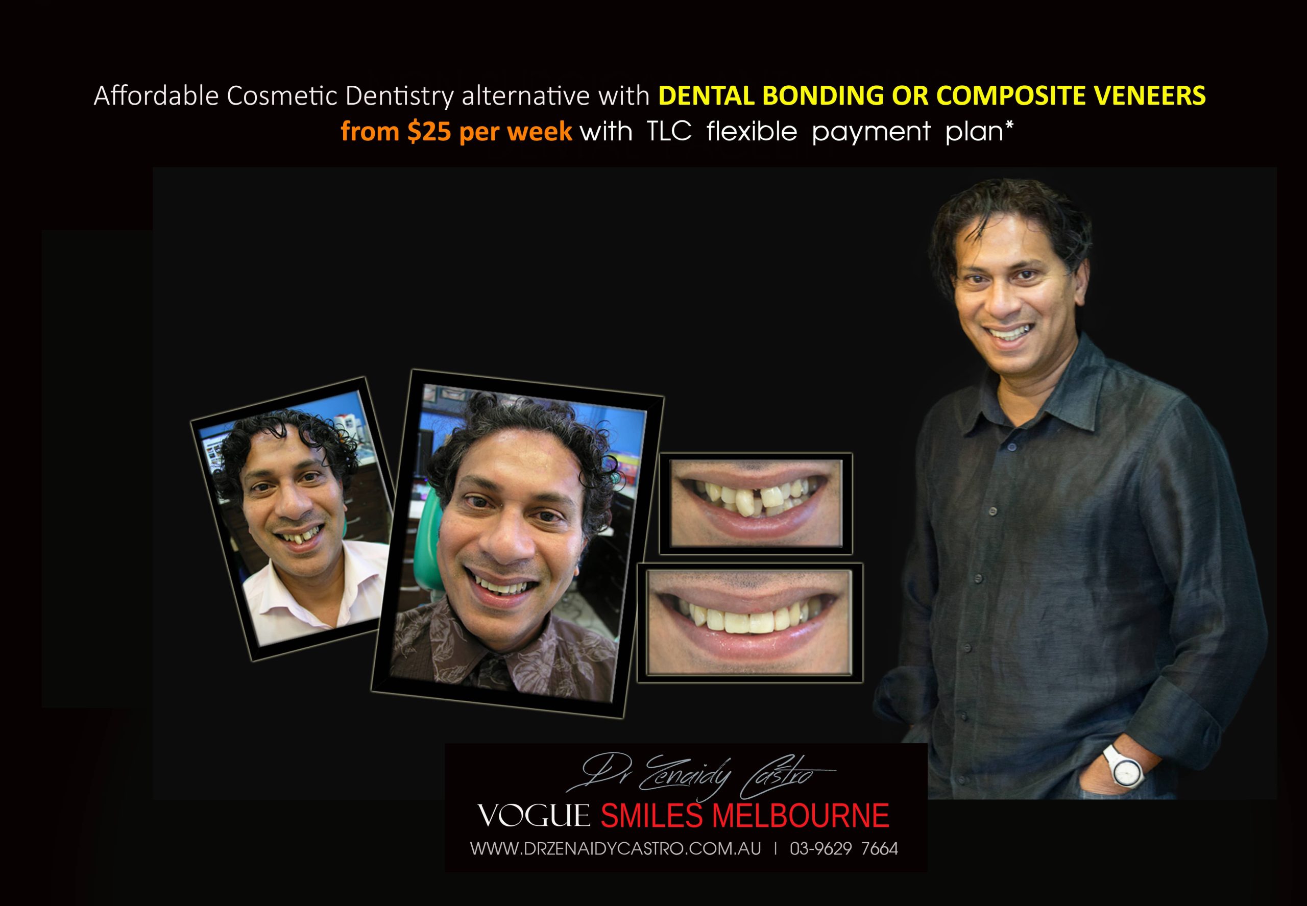 Affordable-Cheap-Cosmetic-Smile-Makeover