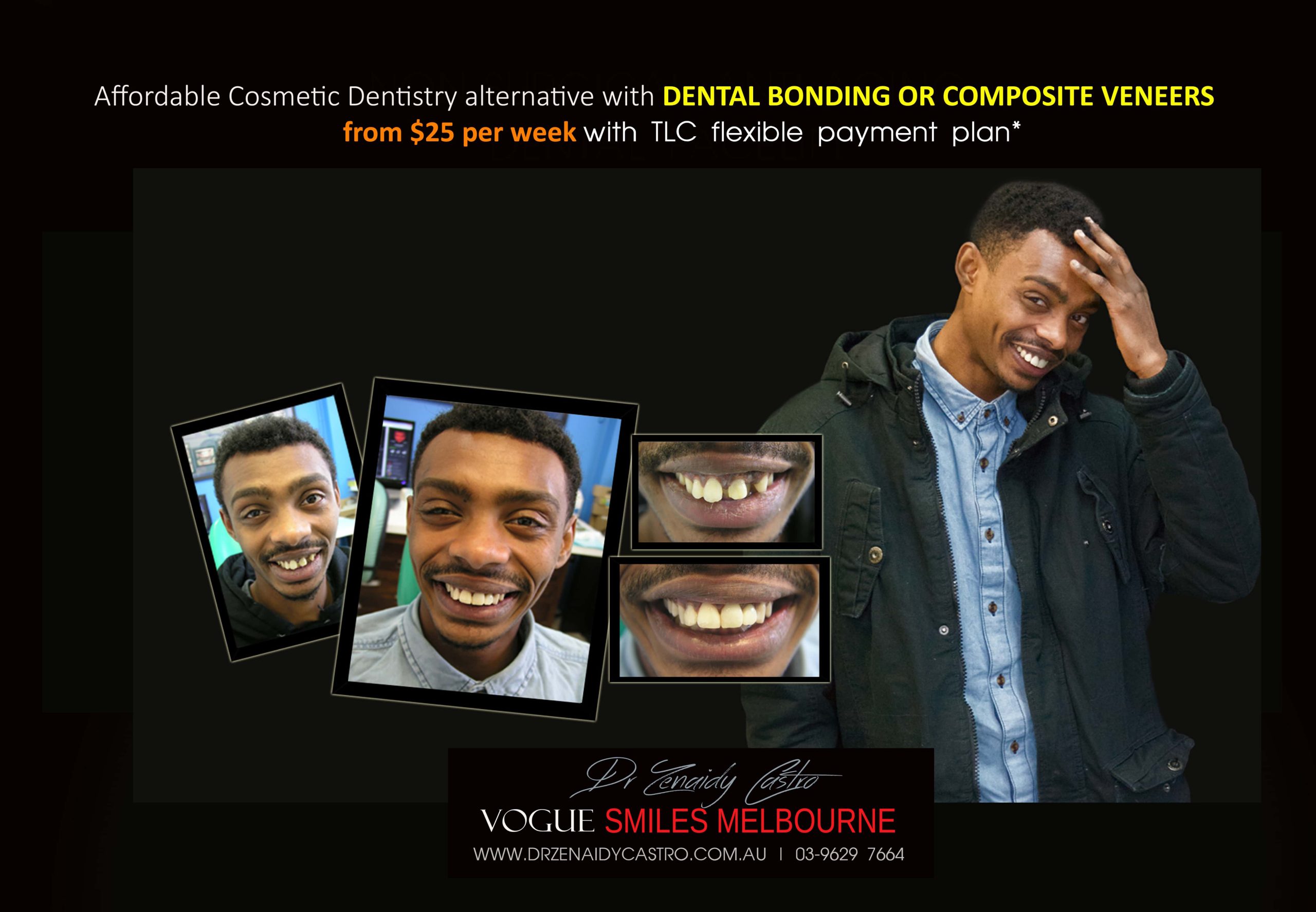 Affordable-Cheap-Cosmetic-Smile-Makeover