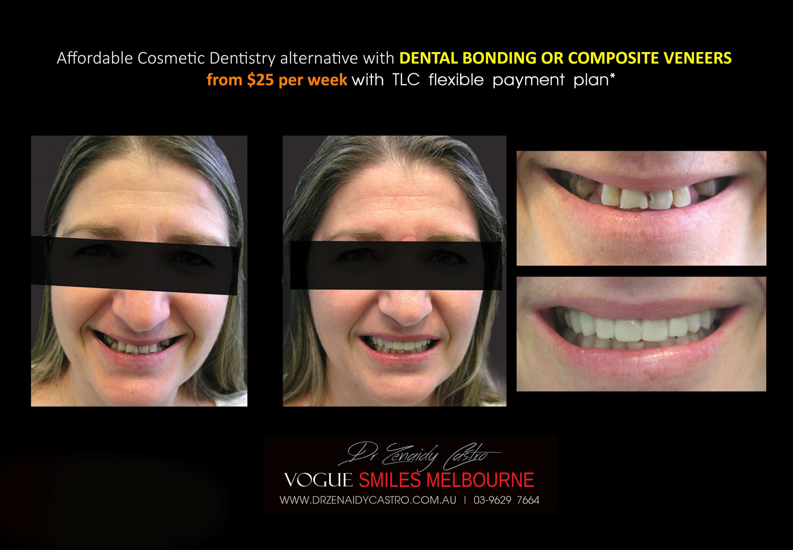 Affordable-Cheap-Cosmetic-Smile-Makeover