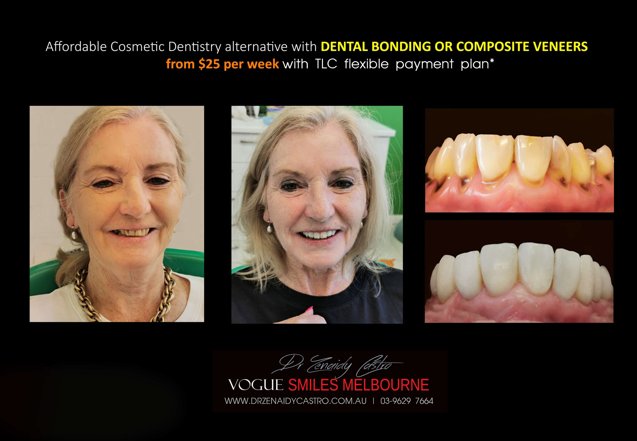 Affordable-Cheap-Cosmetic-Smile-Makeover