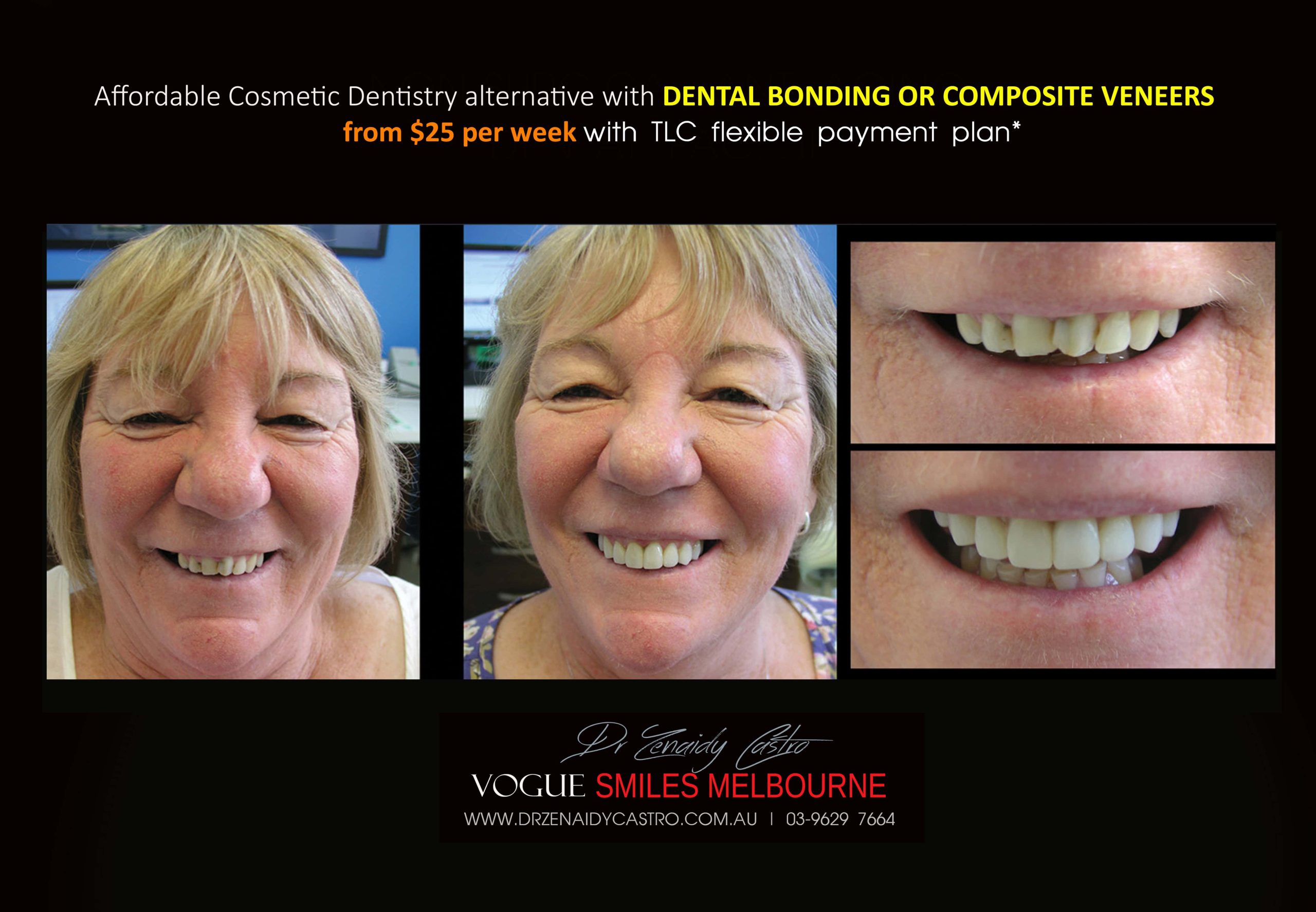 Affordable-Cheap-Cosmetic-Smile-Makeover