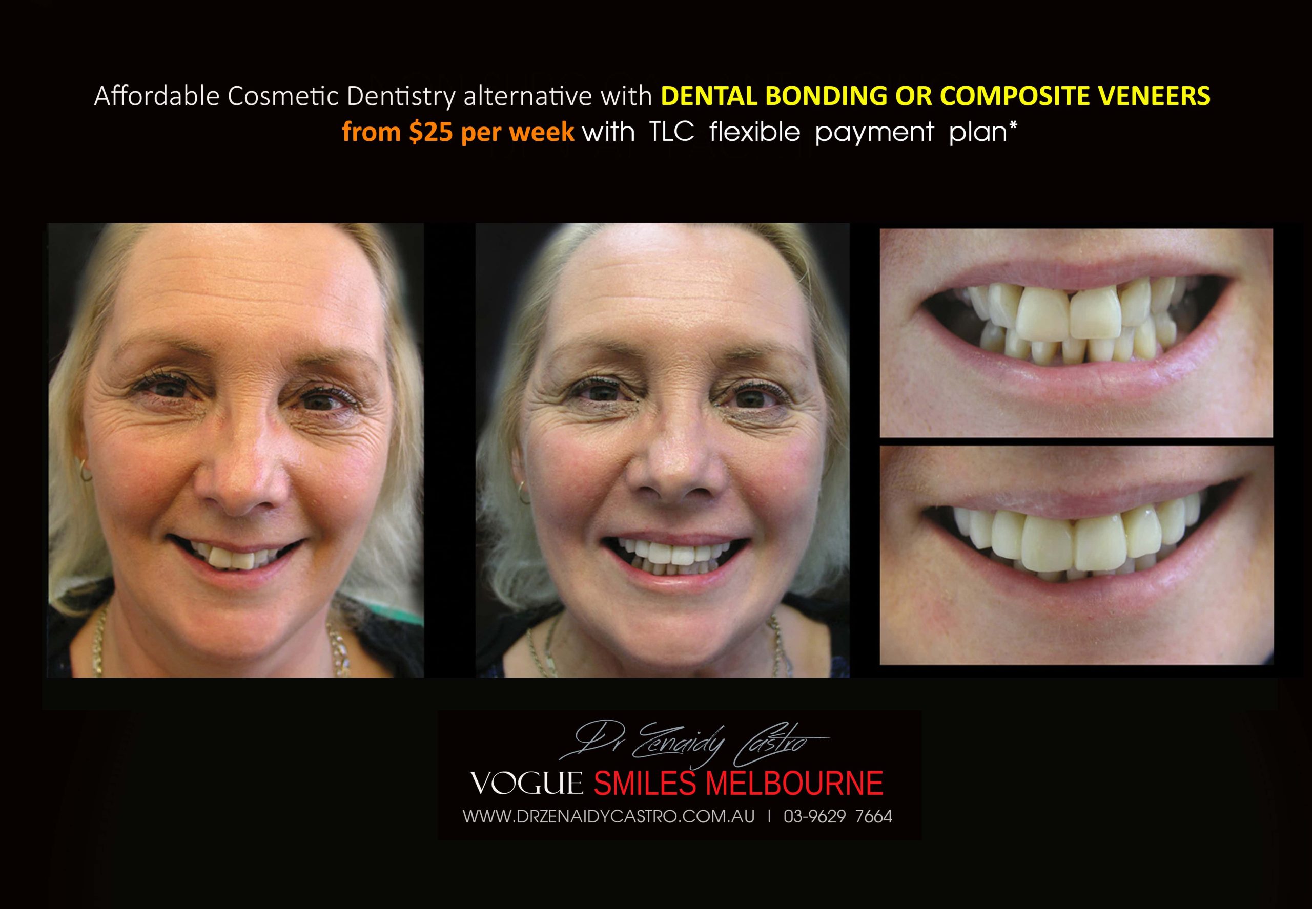 Affordable-Cheap-Cosmetic-Smile-Makeover