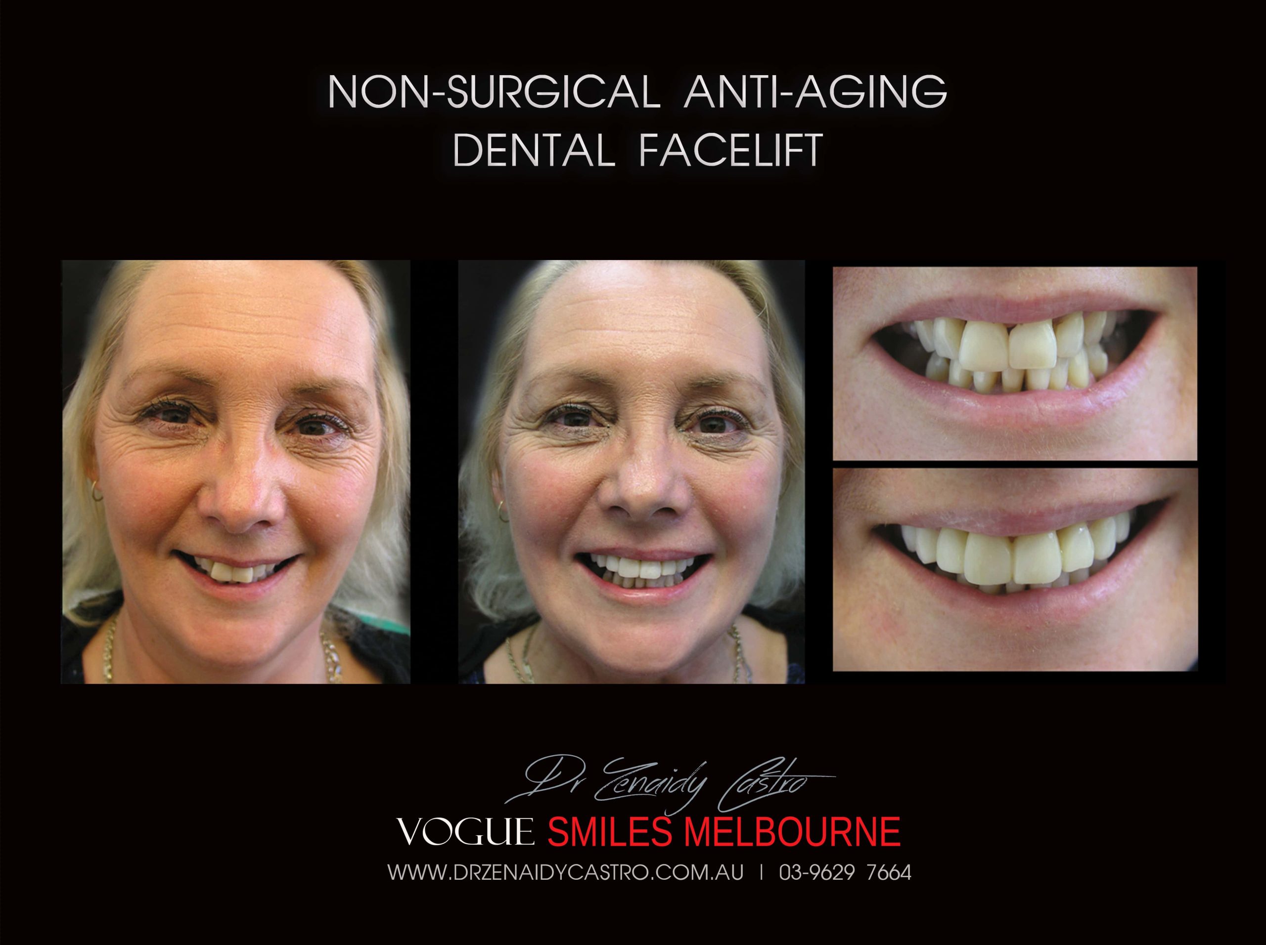 Affordable-Cheap-Cosmetic-Smile-Makeover