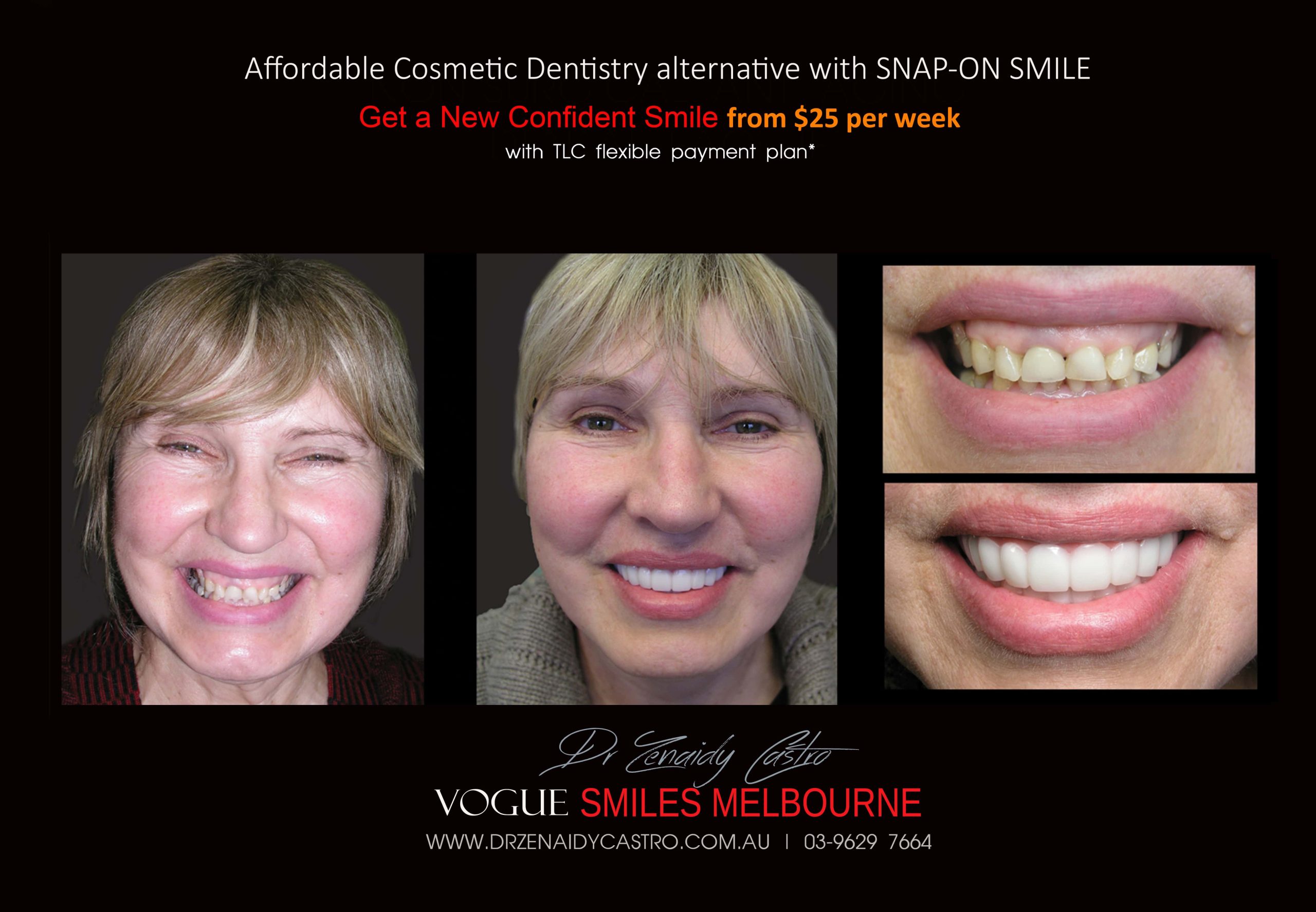 Affordable-Cheap-Cosmetic-Smile-Makeover