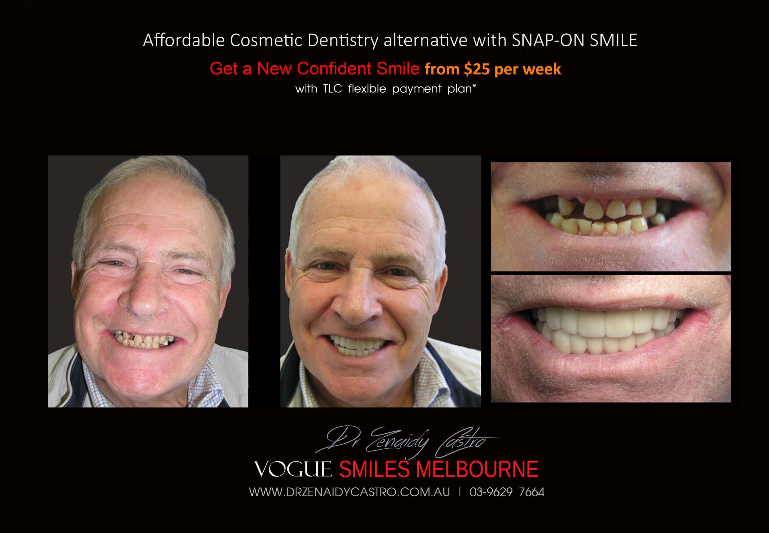 Affordable-Cheap-Cosmetic-Smile-Makeover