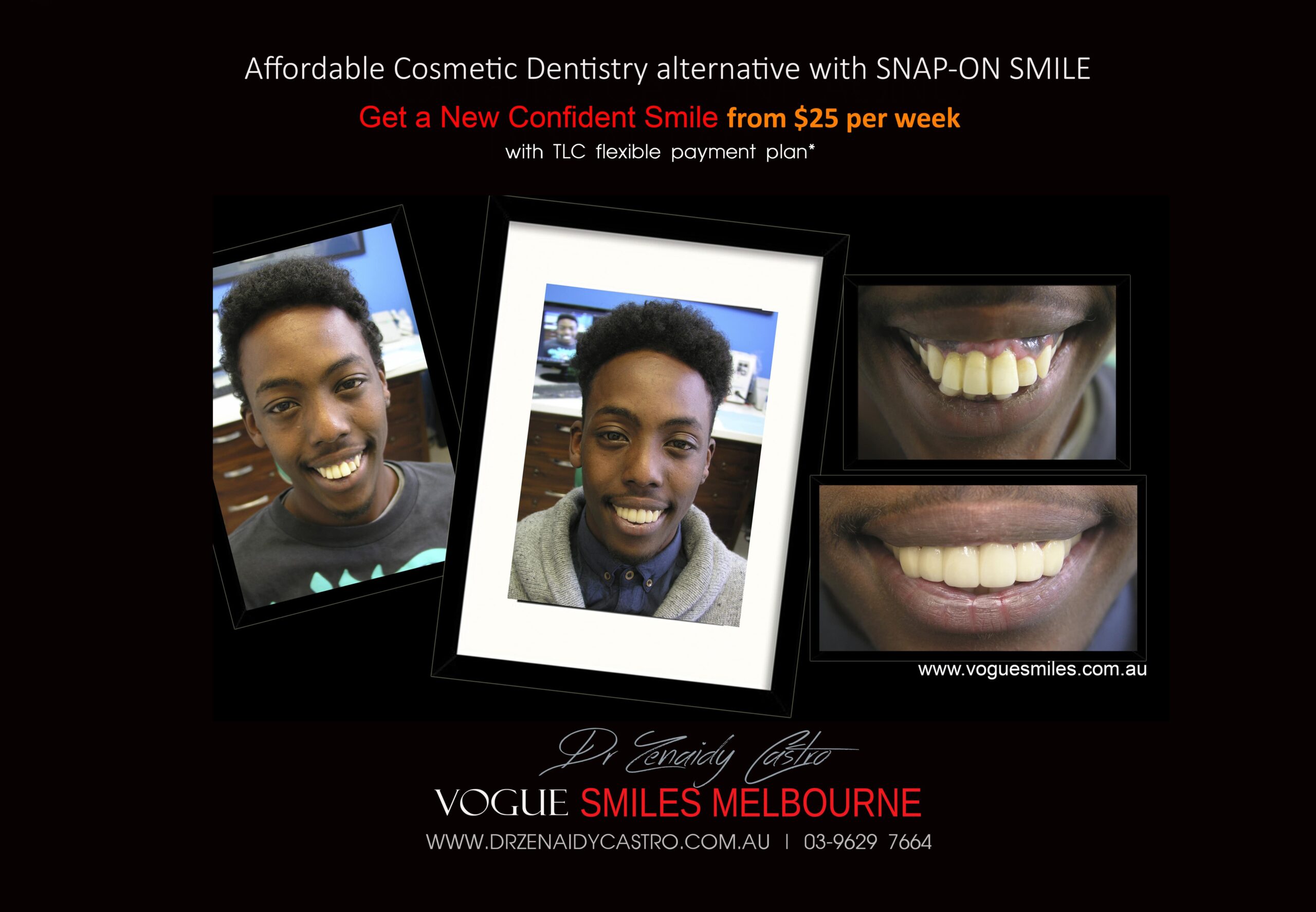 Affordable-Cheap-Cosmetic-Smile-Makeover