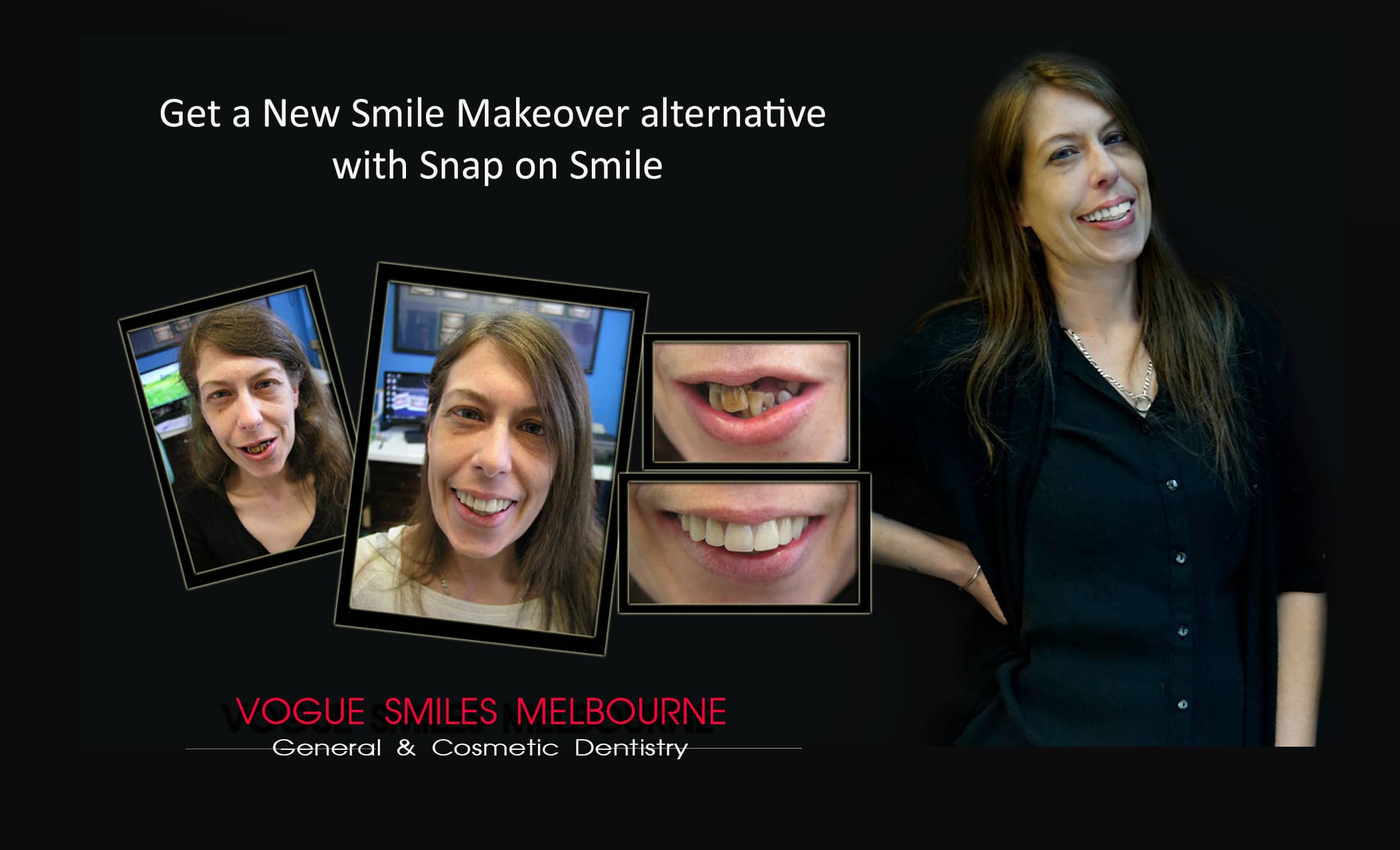 Affordable-Cheap-Cosmetic-Smile-Makeover