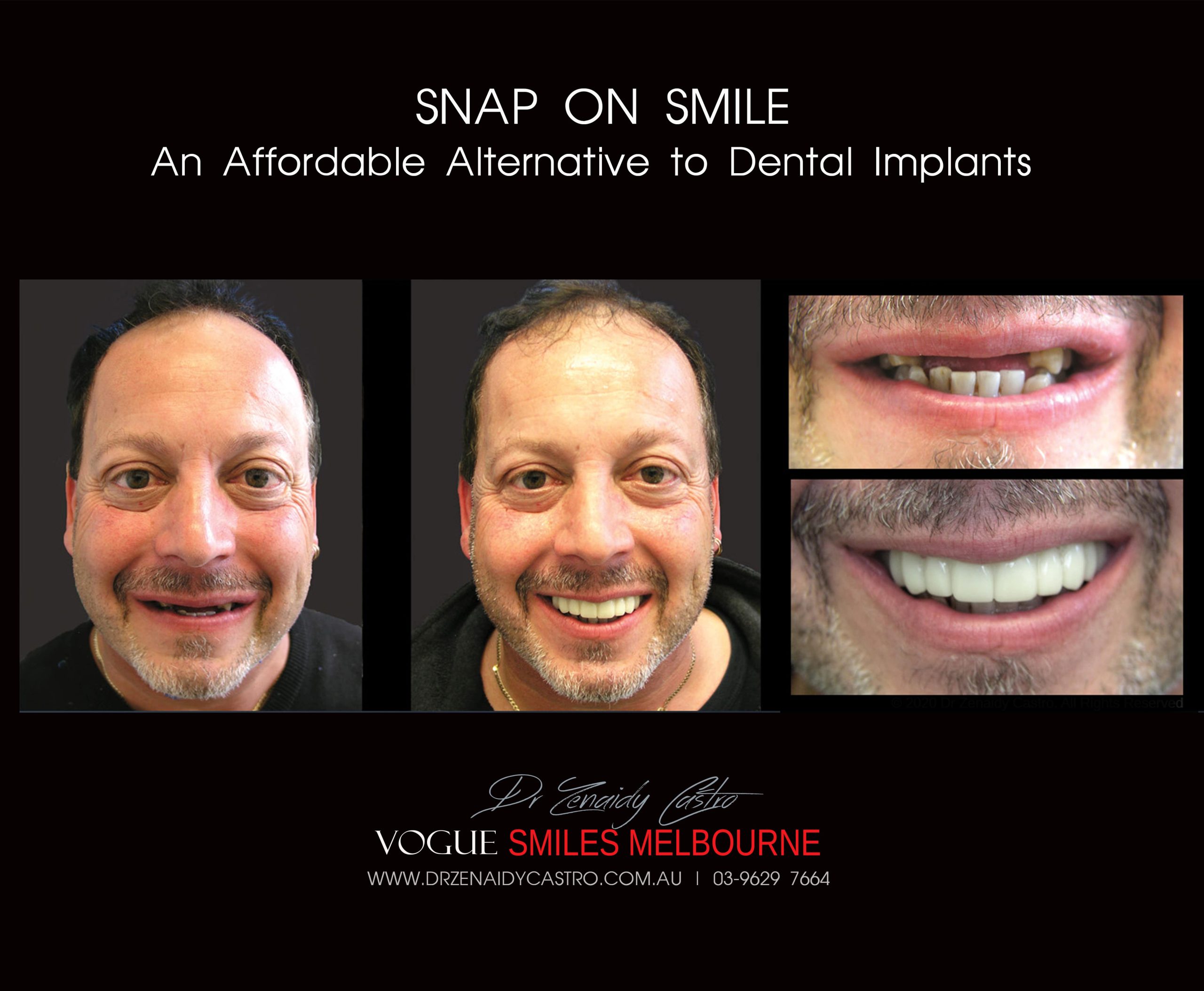 Affordable-Cheap-Cosmetic-Smile-Makeover