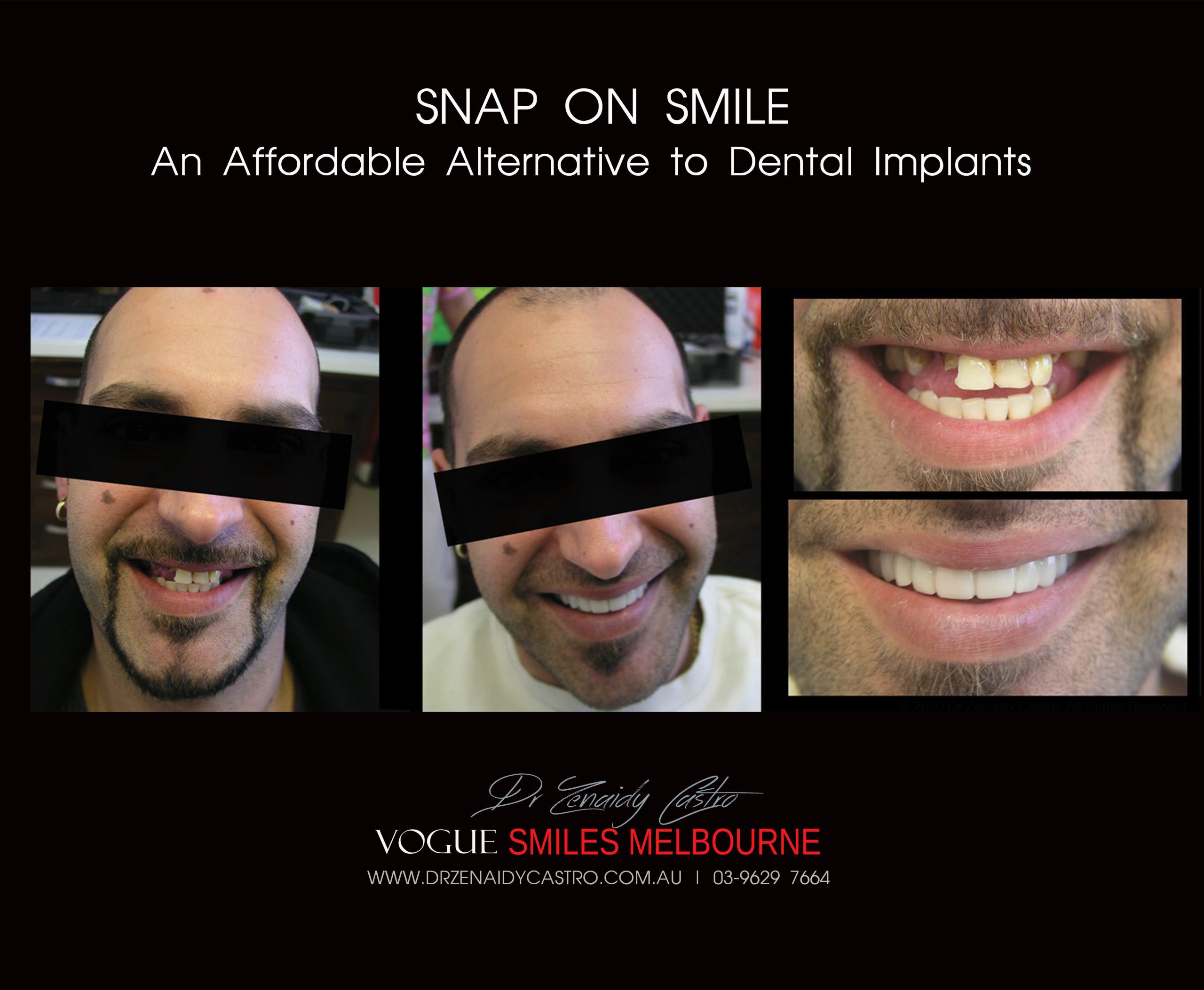 Affordable-Cheap-Cosmetic-Smile-Makeover