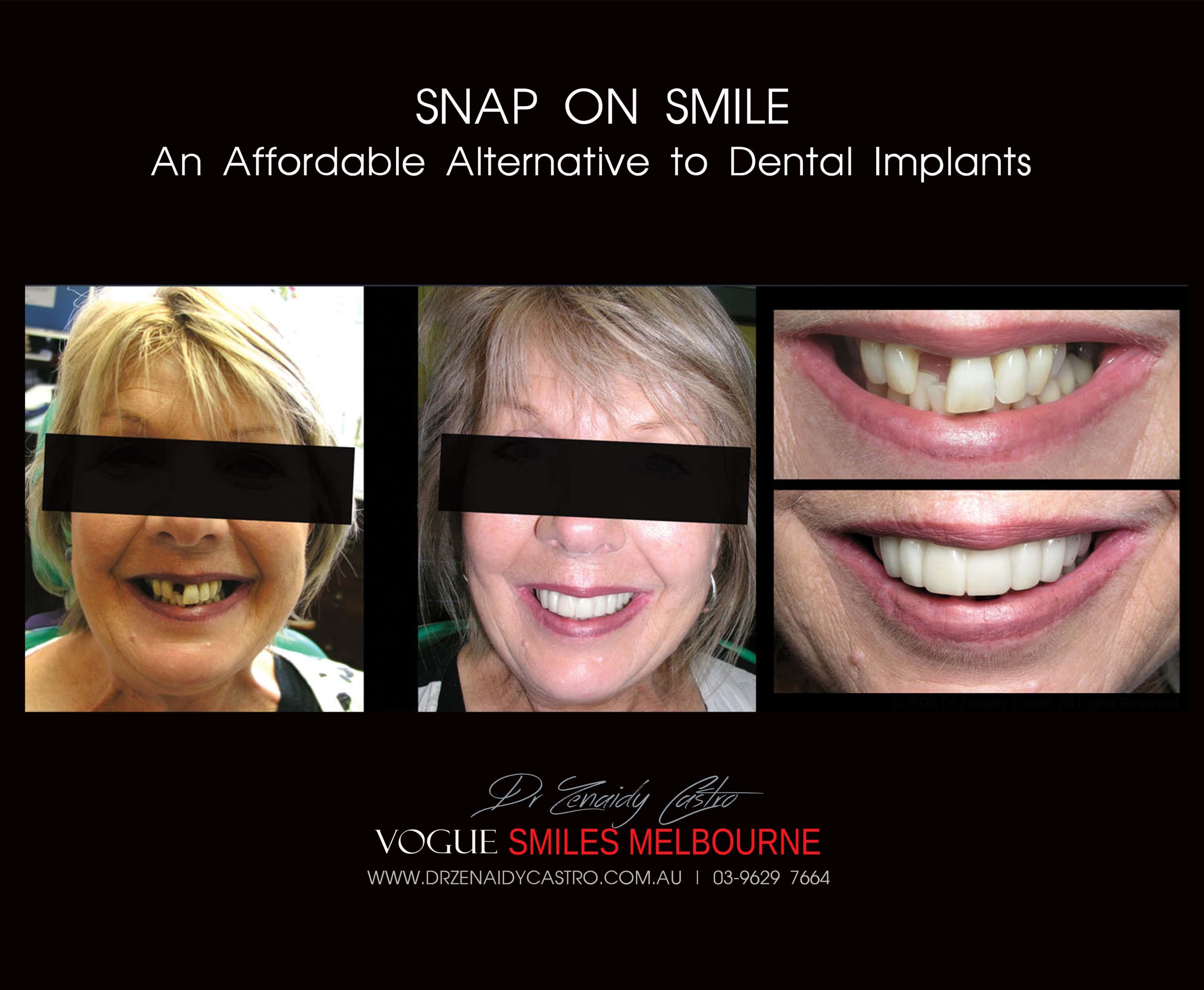 Affordable-Cheap-Cosmetic-Smile-Makeover