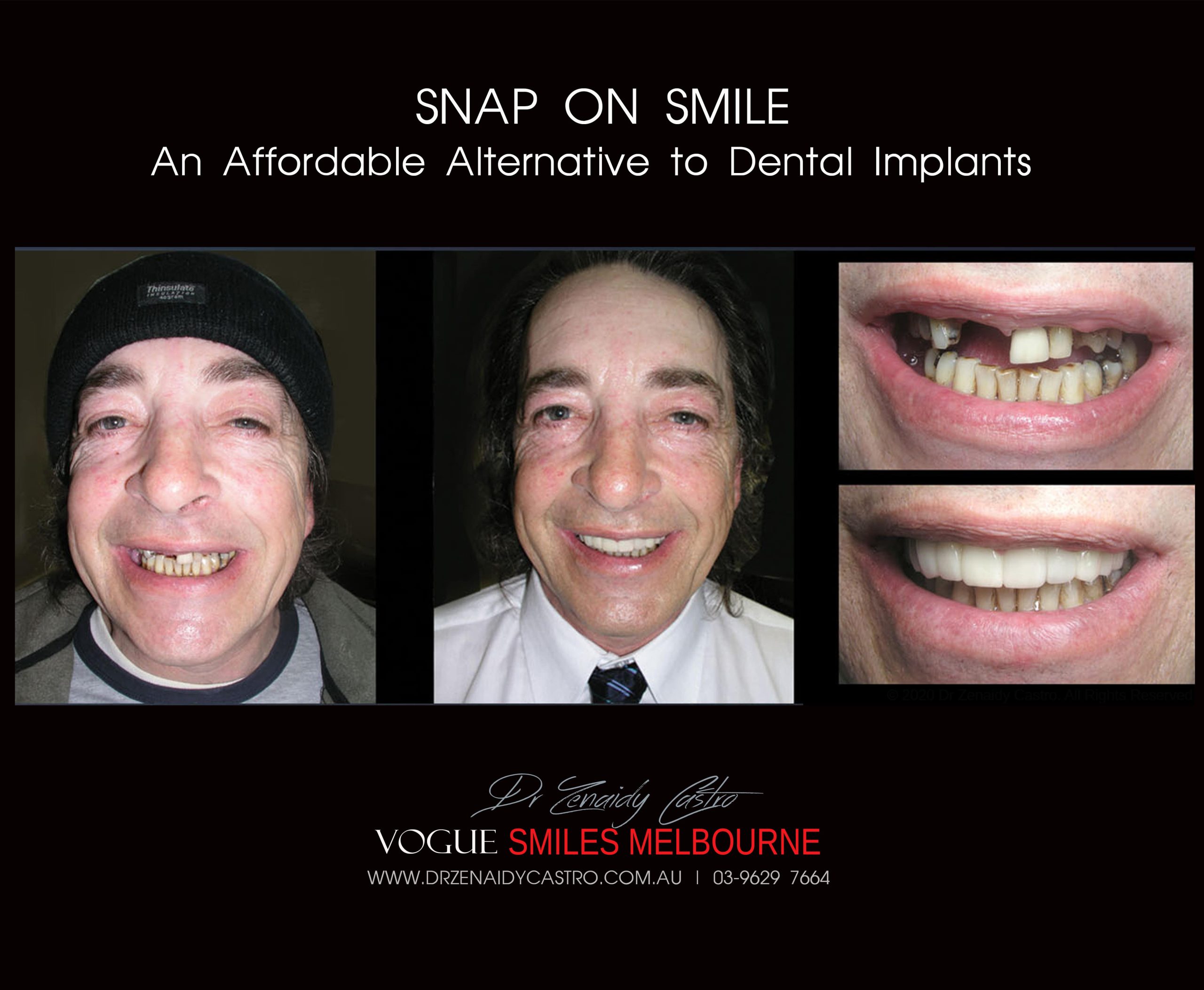 Affordable-Cheap-Cosmetic-Smile-Makeover
