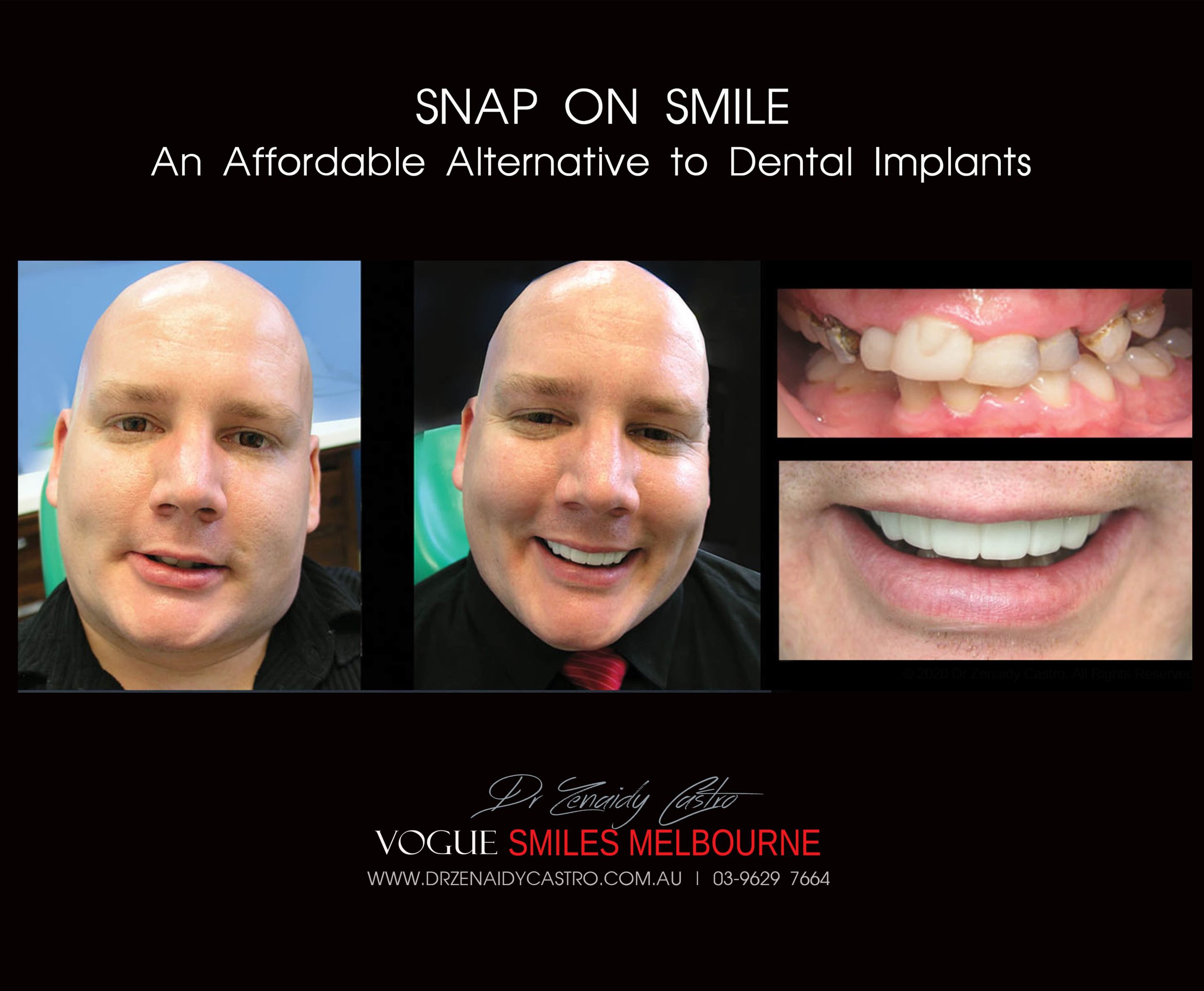 Affordable-Cheap-Cosmetic-Smile-Makeover