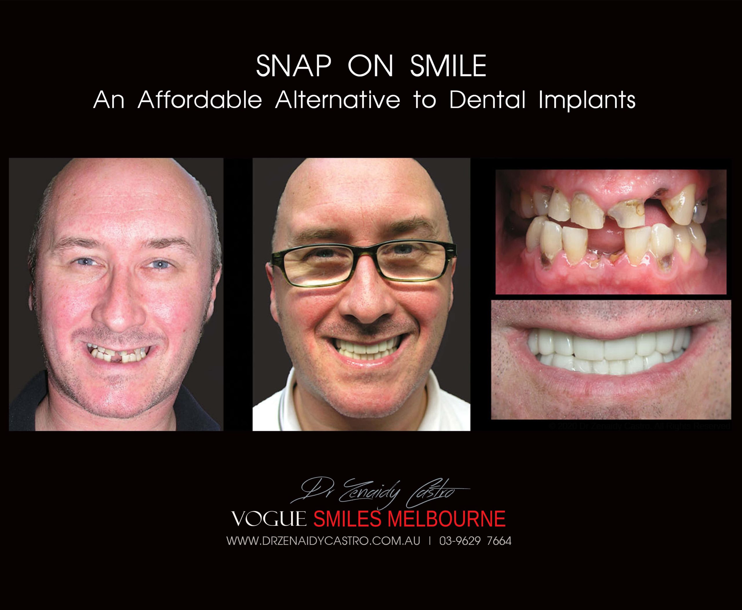 Affordable-Cheap-Cosmetic-Smile-Makeover