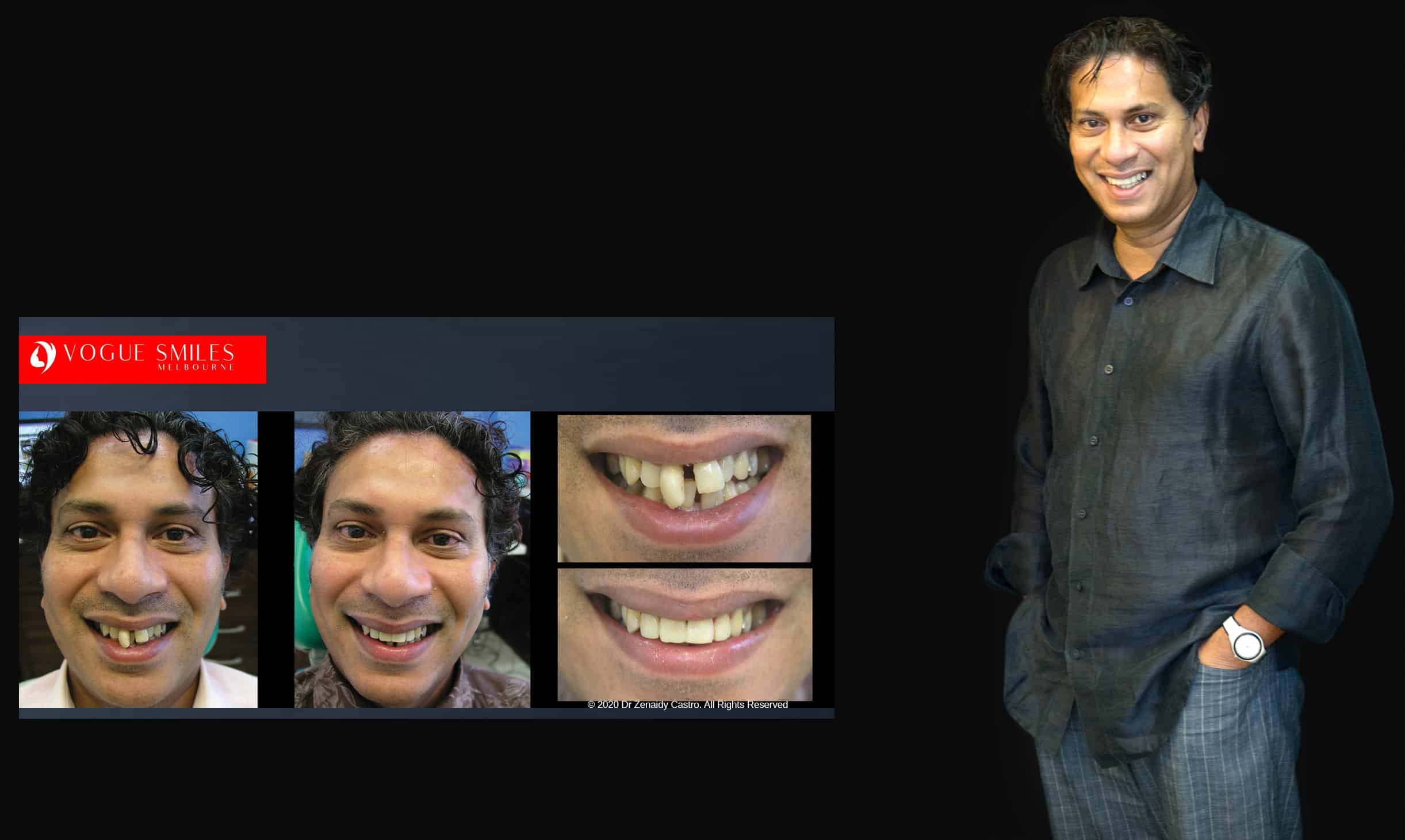 Cosmetic Dentistry near Mulgrave VIC - Cosmetic Dentist in Mulgrave VIC Australia