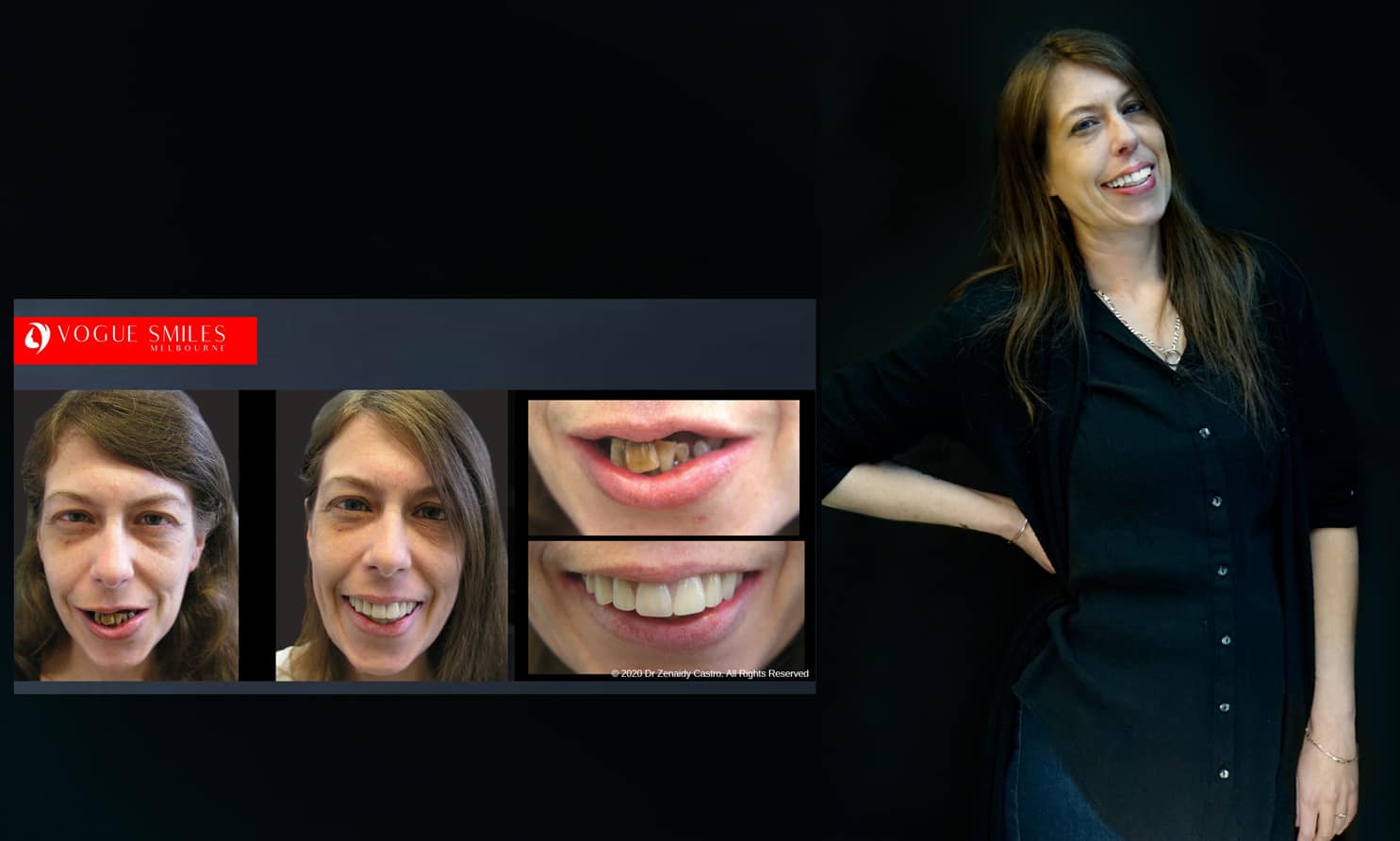Cosmetic Dentistry near Mulgrave VIC - Cosmetic Dentist in Mulgrave VIC Australia