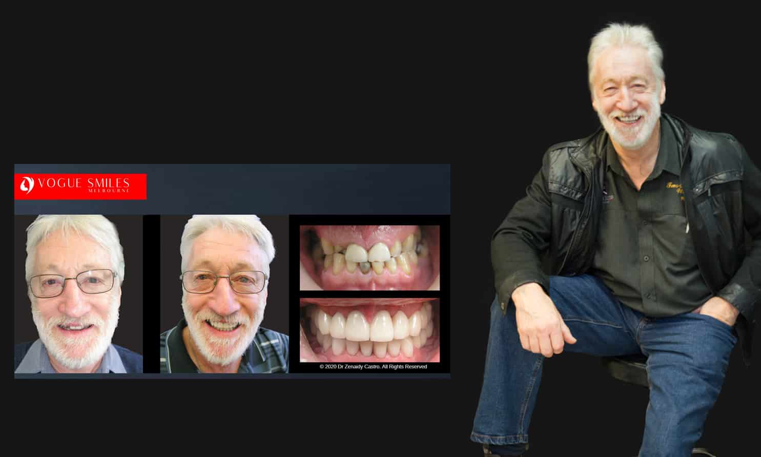 Cosmetic Dentistry near Mulgrave VIC - Cosmetic Dentist in Mulgrave VIC Australia