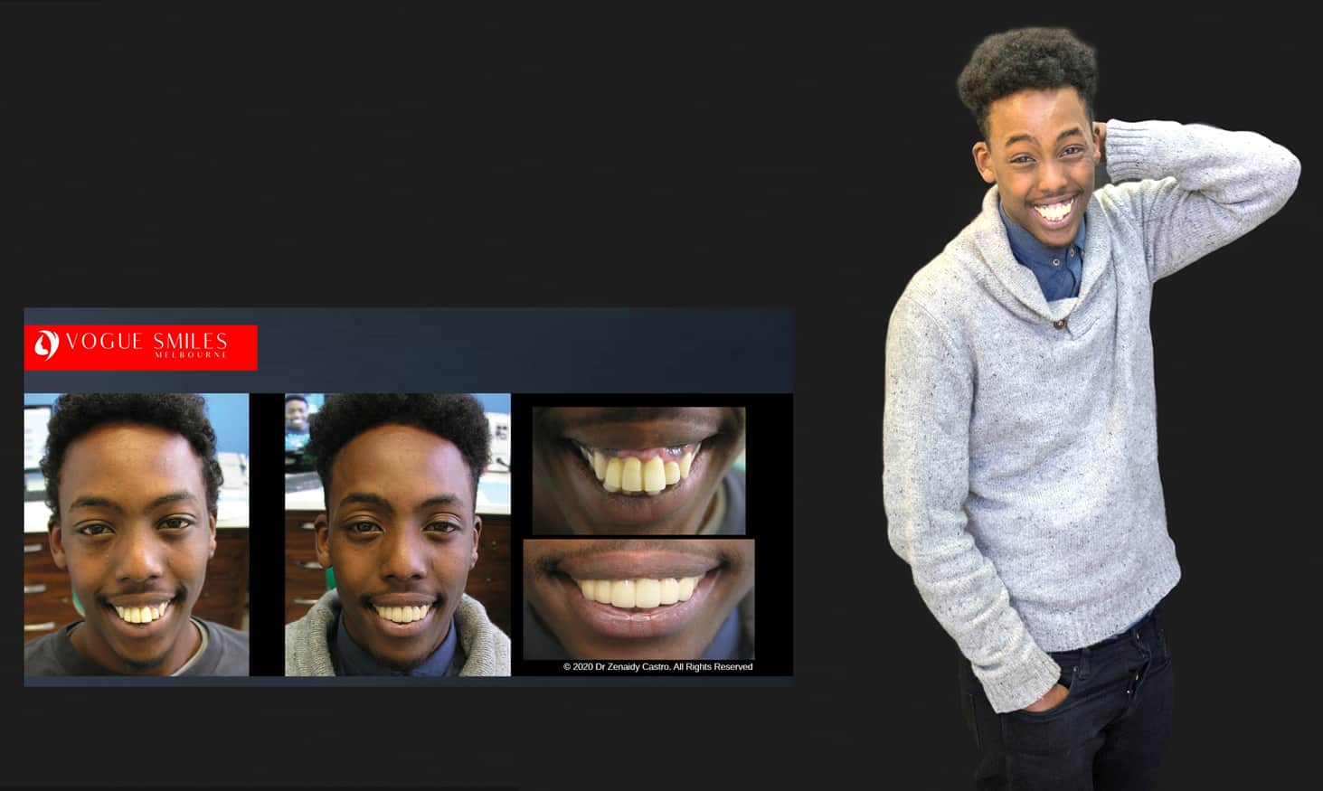 Cosmetic Dentistry near Mulgrave VIC - Cosmetic Dentist in Mulgrave VIC Australia