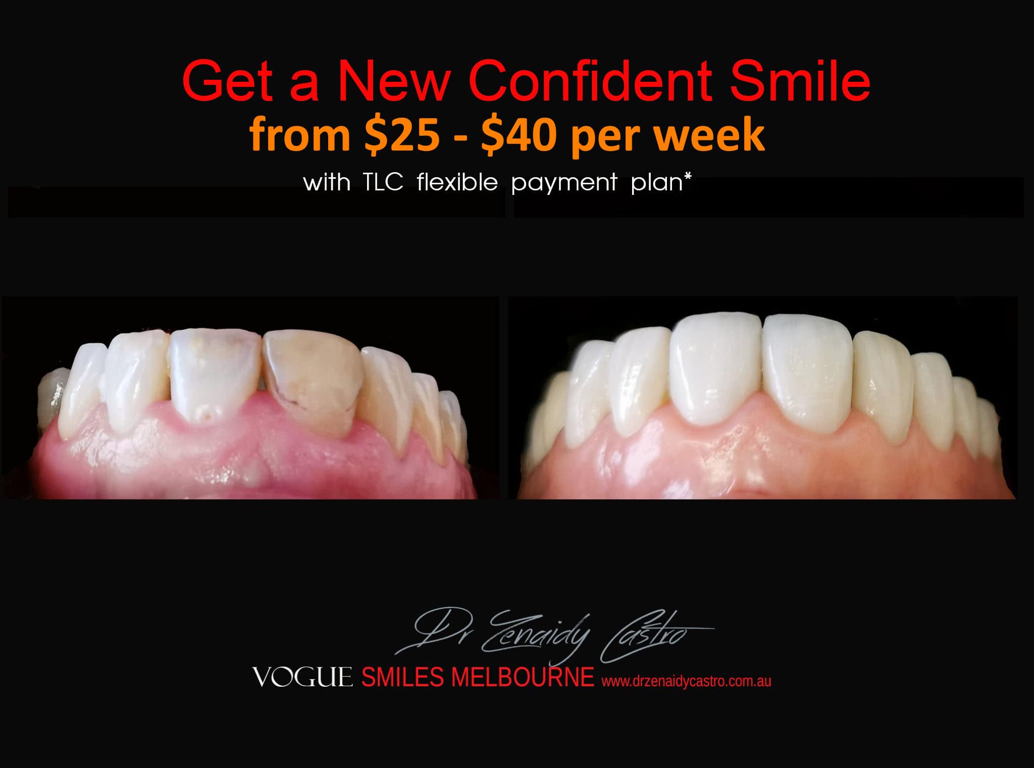 NARROW-SMILES-BROADENING-SMILES