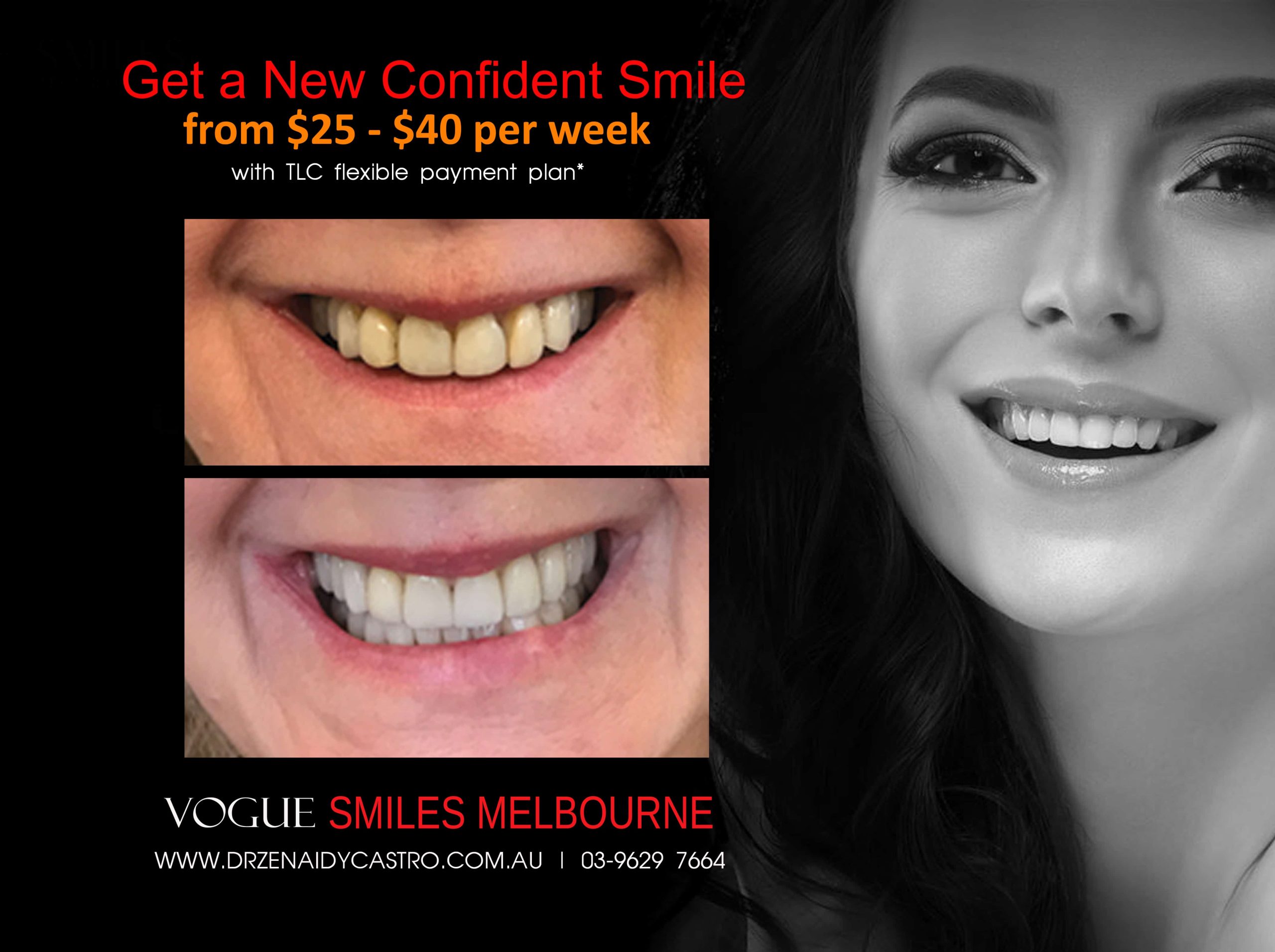 NARROW-SMILES-BROADENING-SMILES
