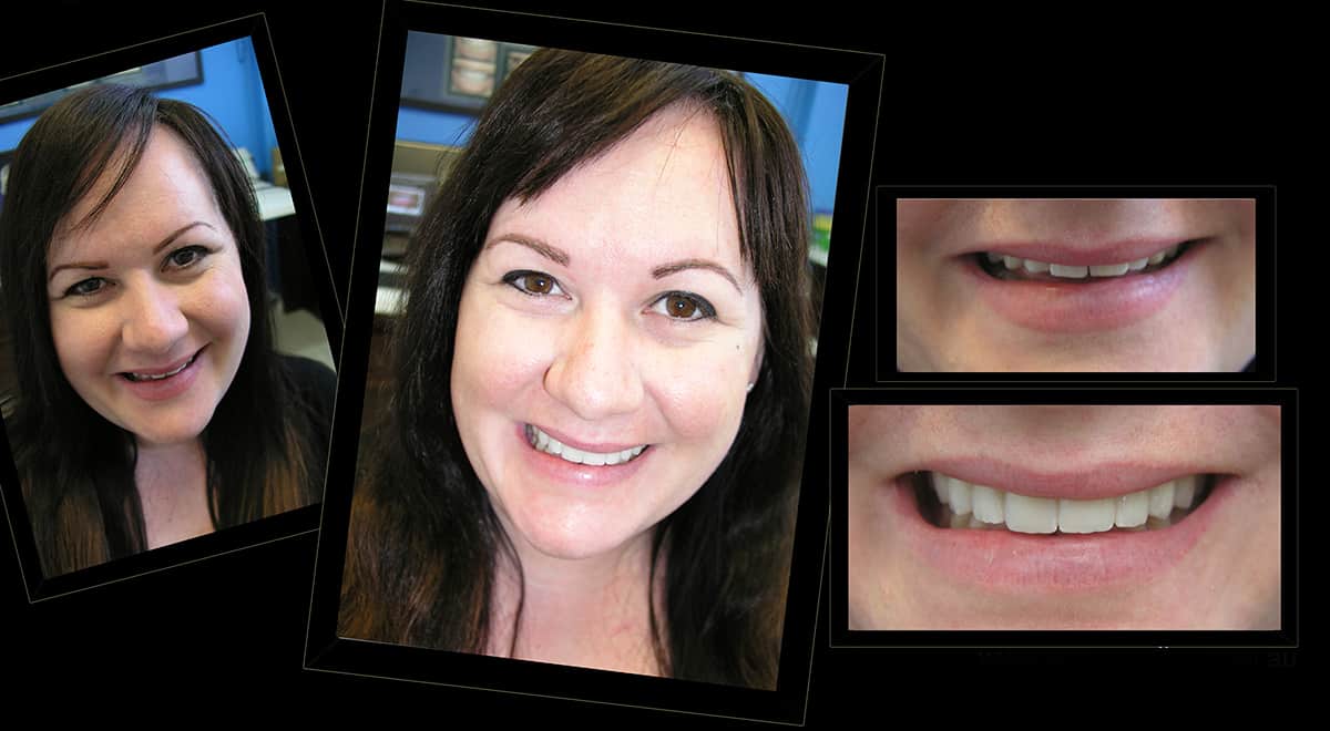 How to Finance Your Smile Makeover Without Breaking the Bank