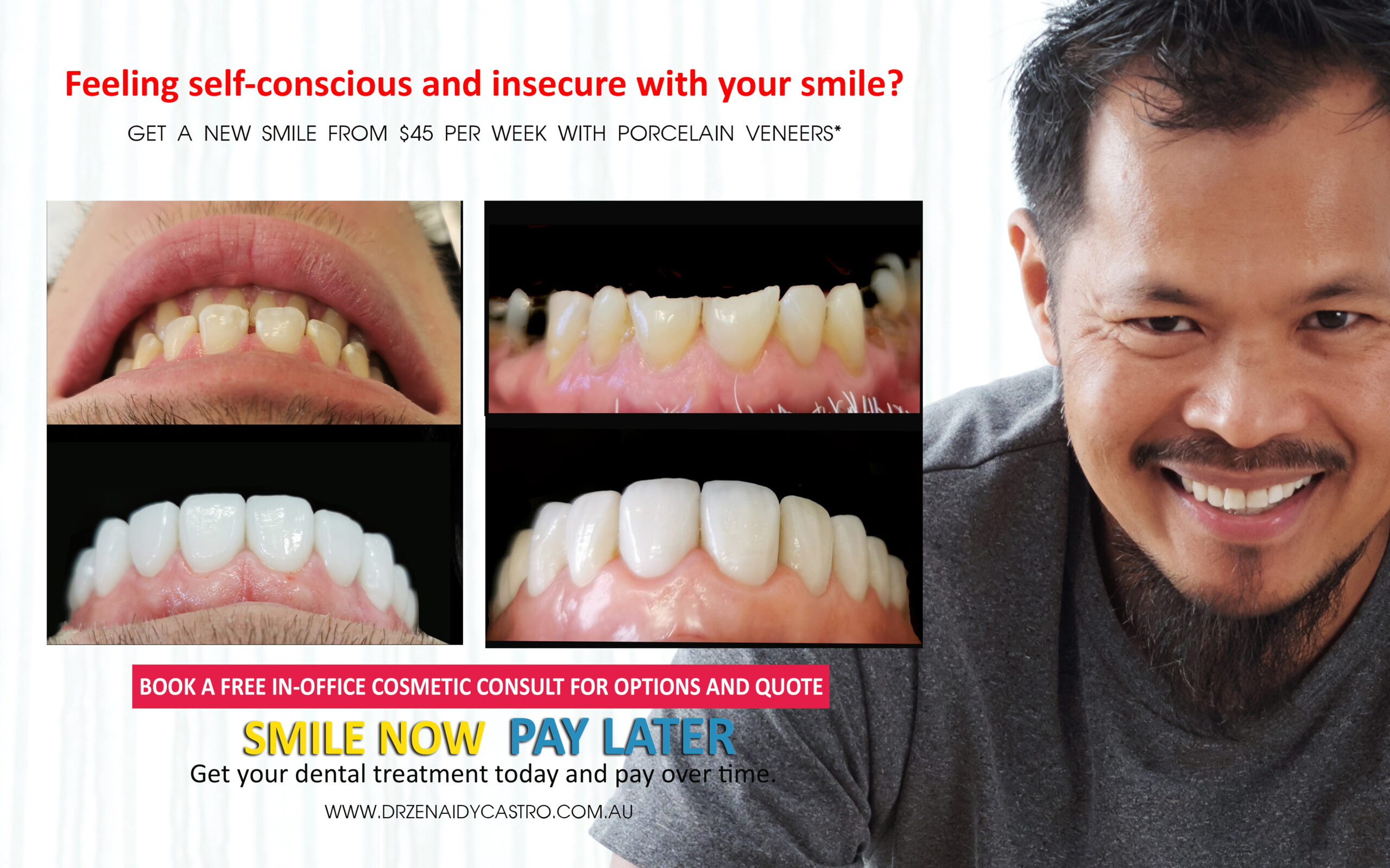 Affordable Smile Makeover Dentistry in Noble Park North. General Dentist Noble Park North- Best Dentist in Noble Park North - Best Dental Clinic in Noble Park North, Best Cosmetic Dentist in Noble Park North. Serving surrounding suburbs Dandenong North, Mulgrave, Springvale, Springvale South, Noble Park, Rowville, Wheelers Hill, Keysborough, and Endeavour Hills, Mulgrave, Glen Waverly
